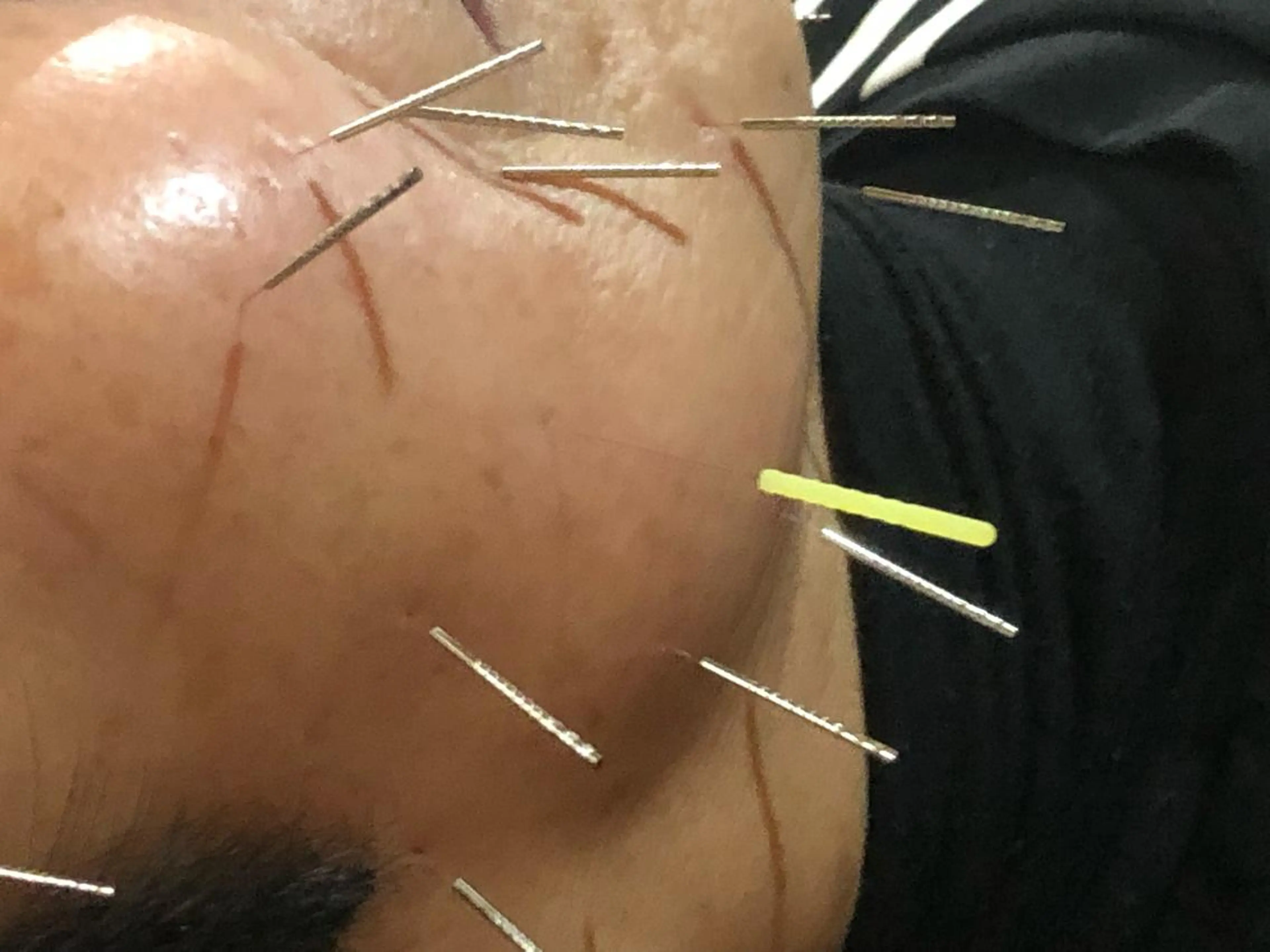 水島 秀輝（美容鍼灸師）のその他イメージ