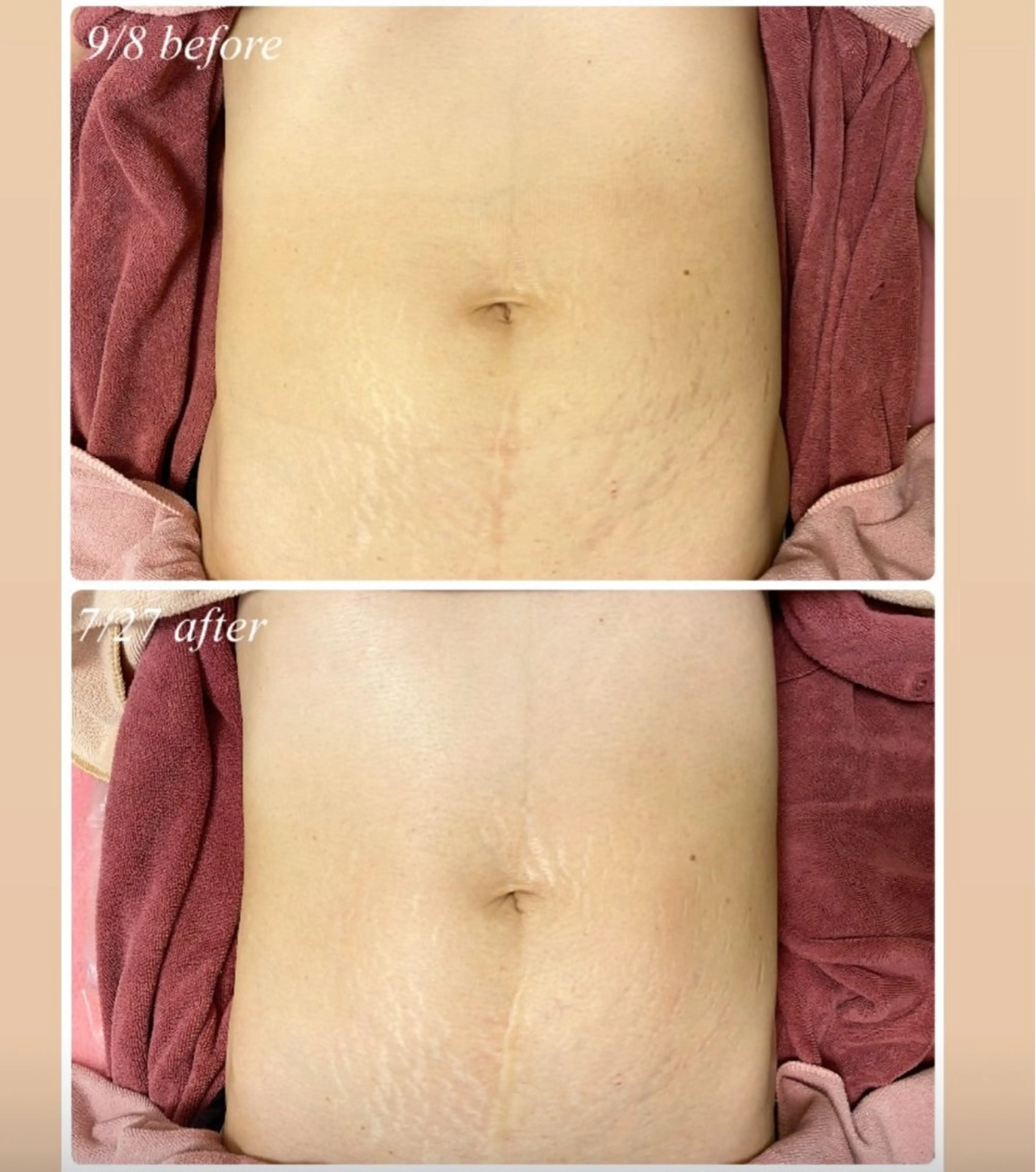 La Colzaのネイルデザイン