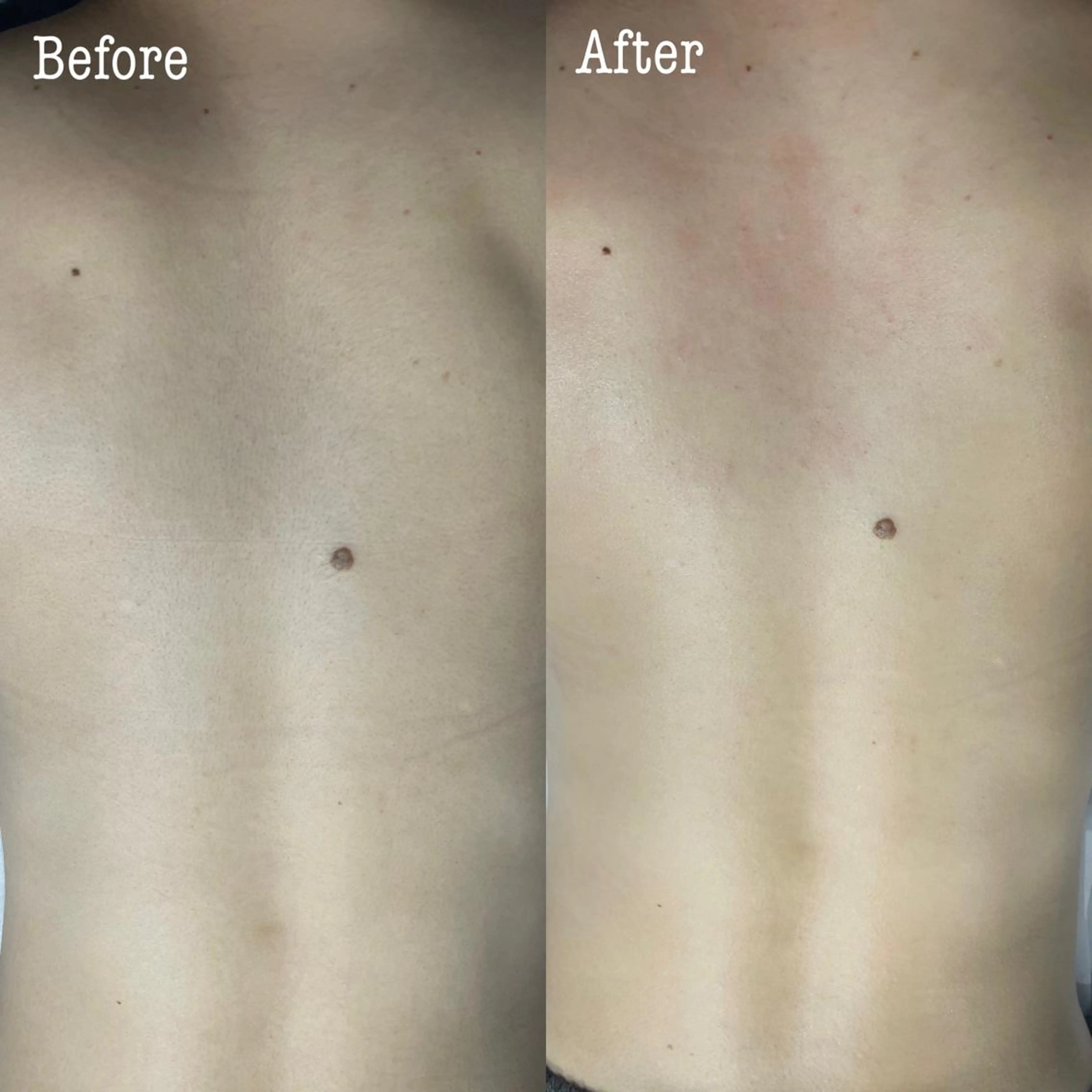 メンズ 脱毛 a laise 斉藤（表参道）のエステ・リラクイメージ