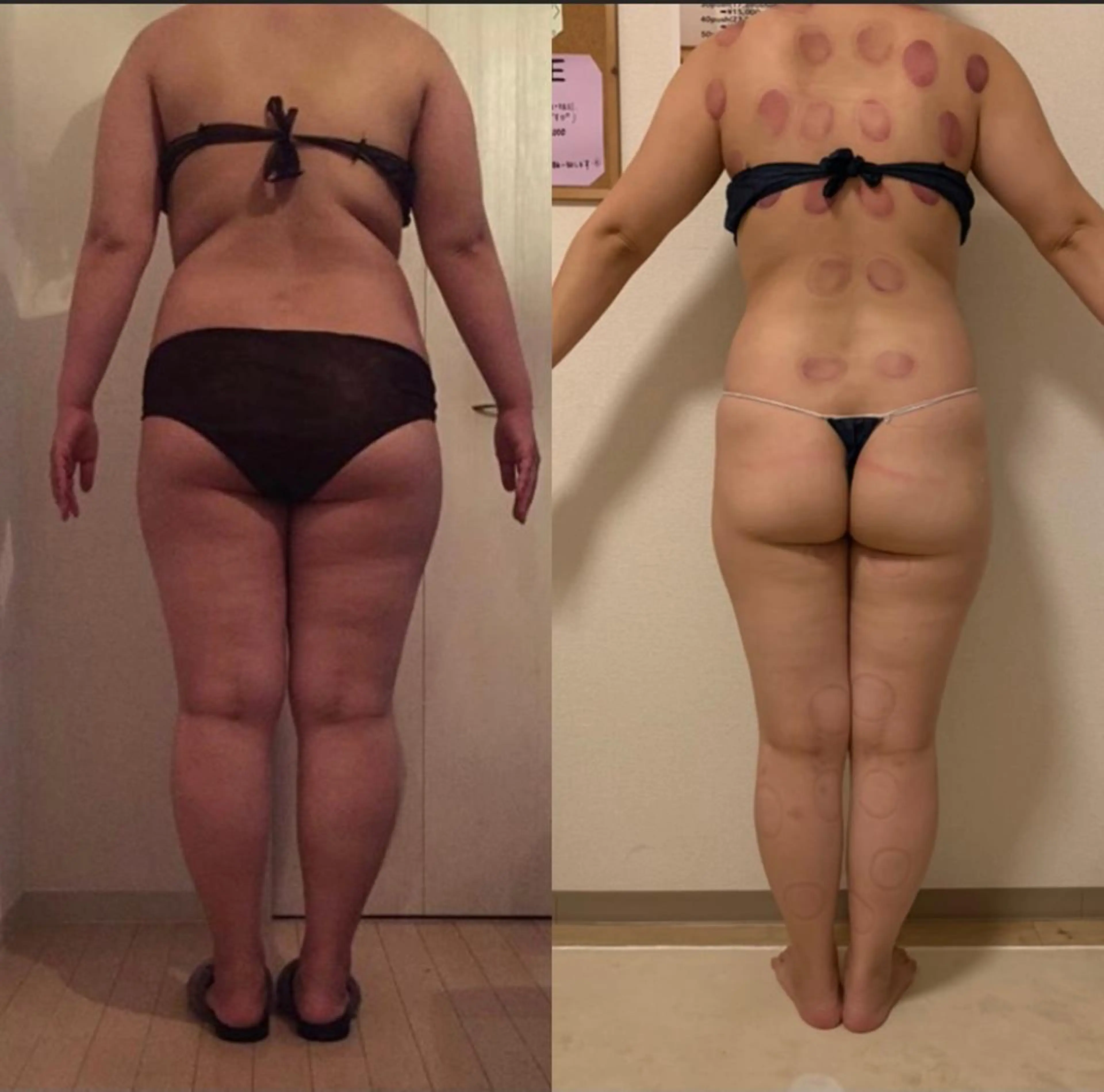 a  room salonのエステ・リラクイメージ