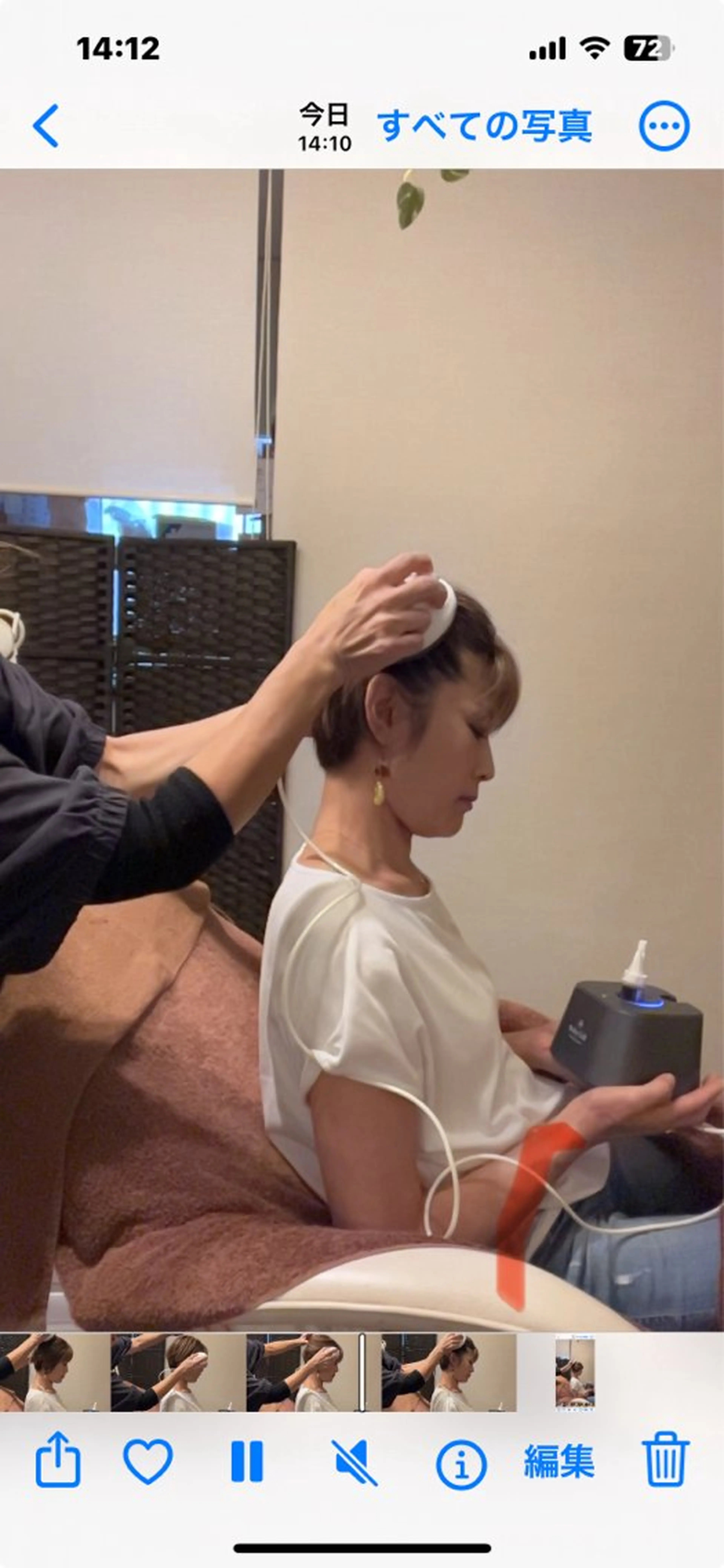 頭皮毛穴洗浄後→エクソソーム美容液導入頭皮ケアの写真