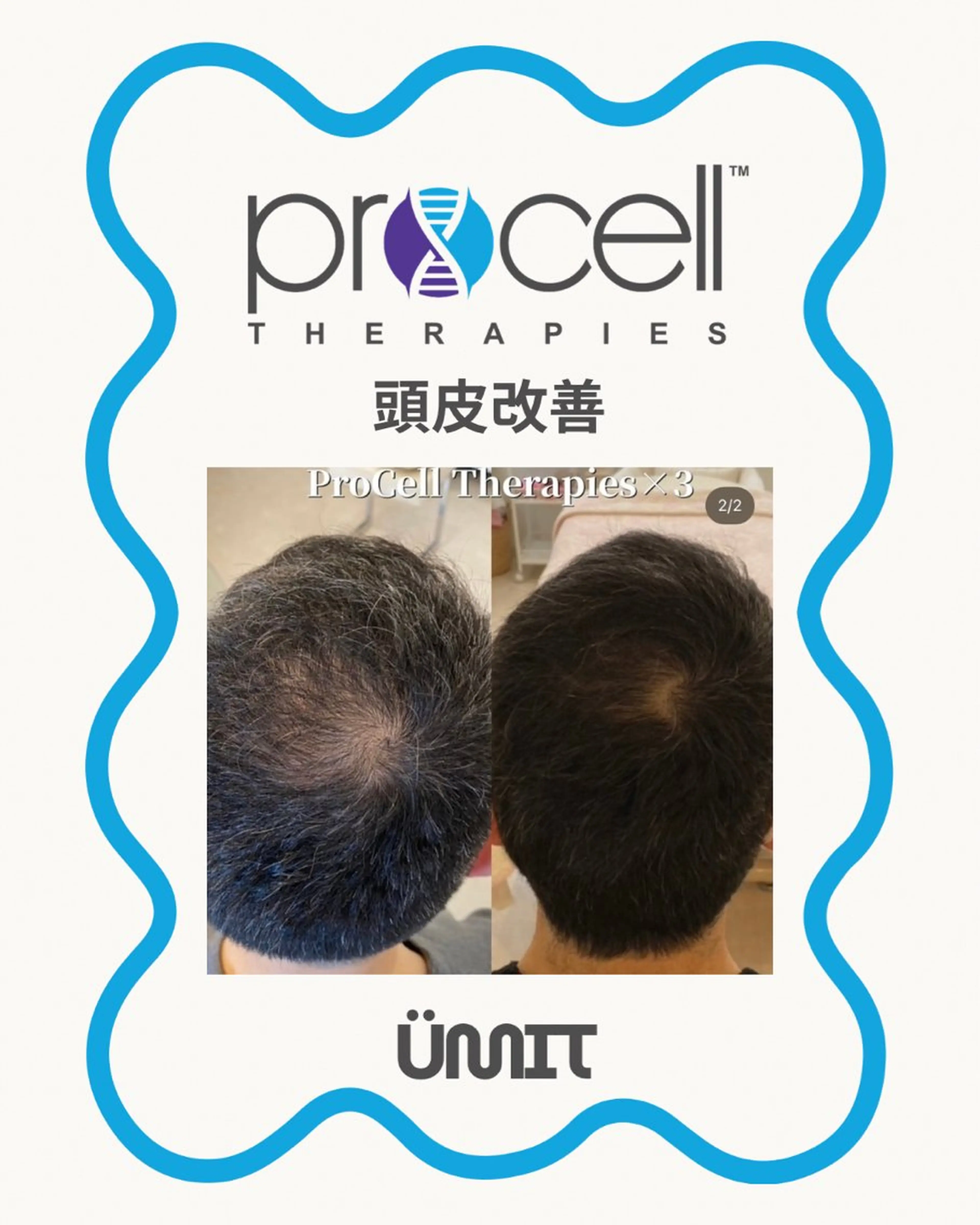 メンズ ヘッドスパ Ümit（ユミト） プロセルセラピーズのネイルデザイン