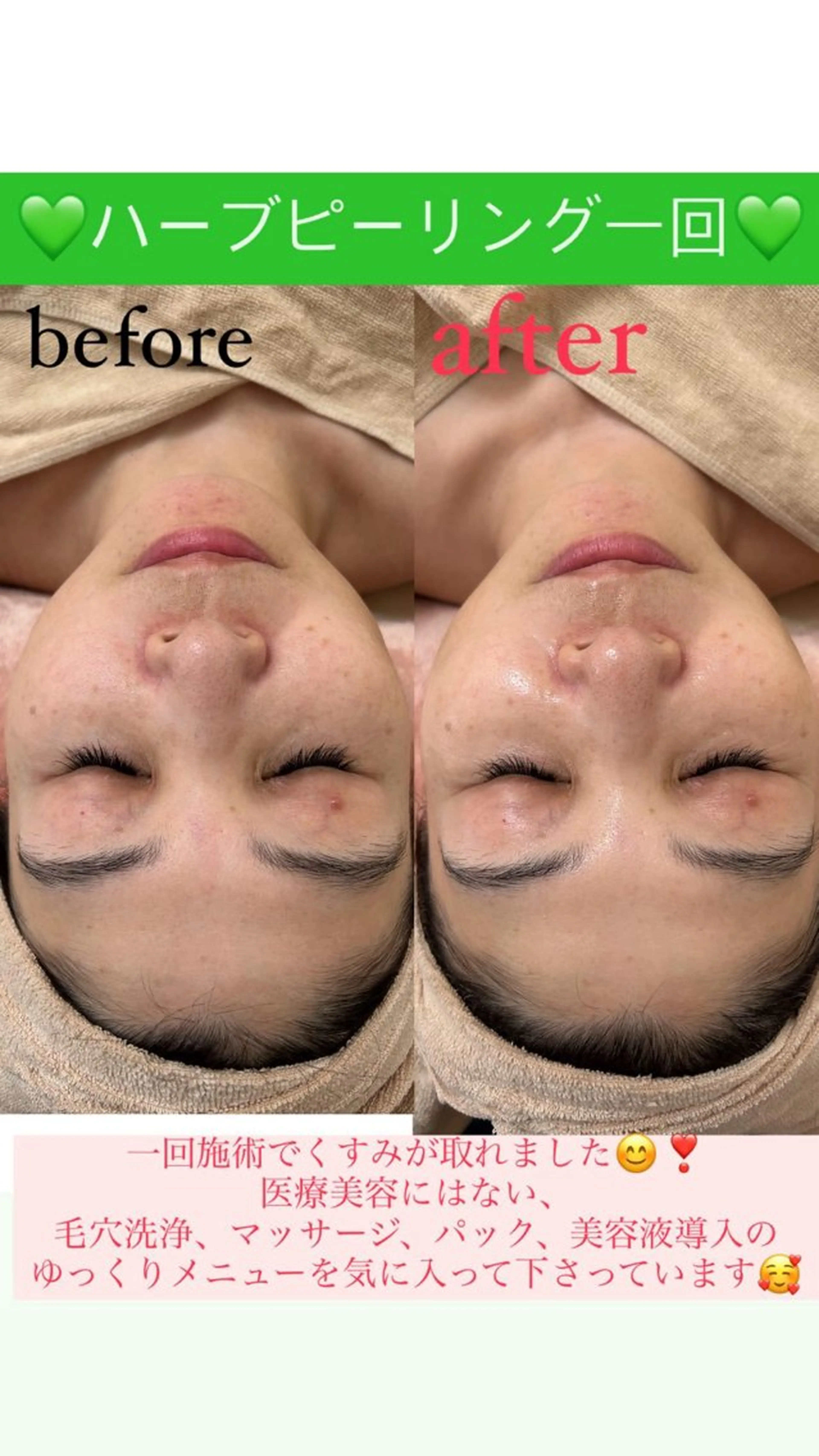 メンズ エステ Salon de Lino 御器所のエステ・リラクイメージ