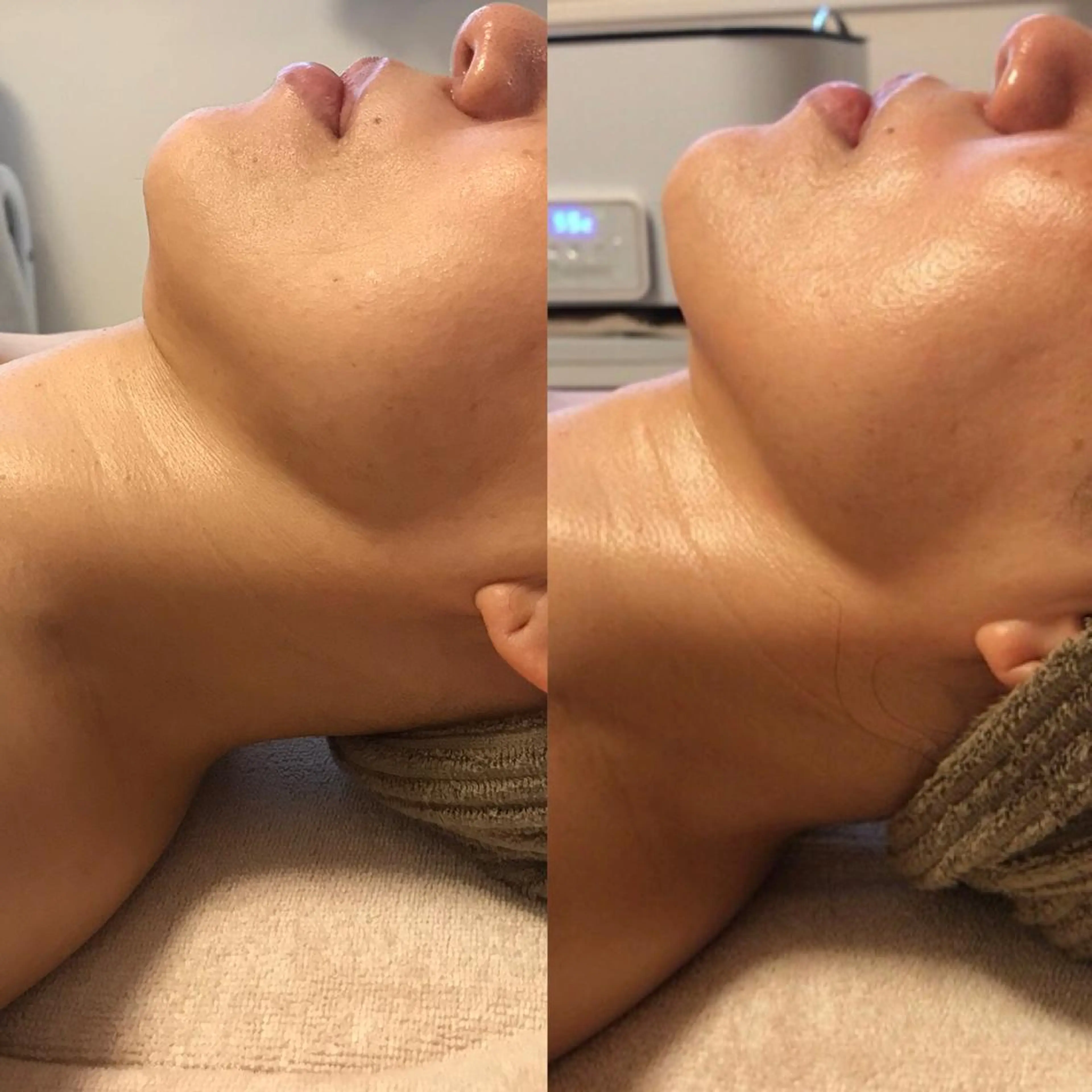 エステ 大名 Kalon（カロン）のエステ・リラクイメージ