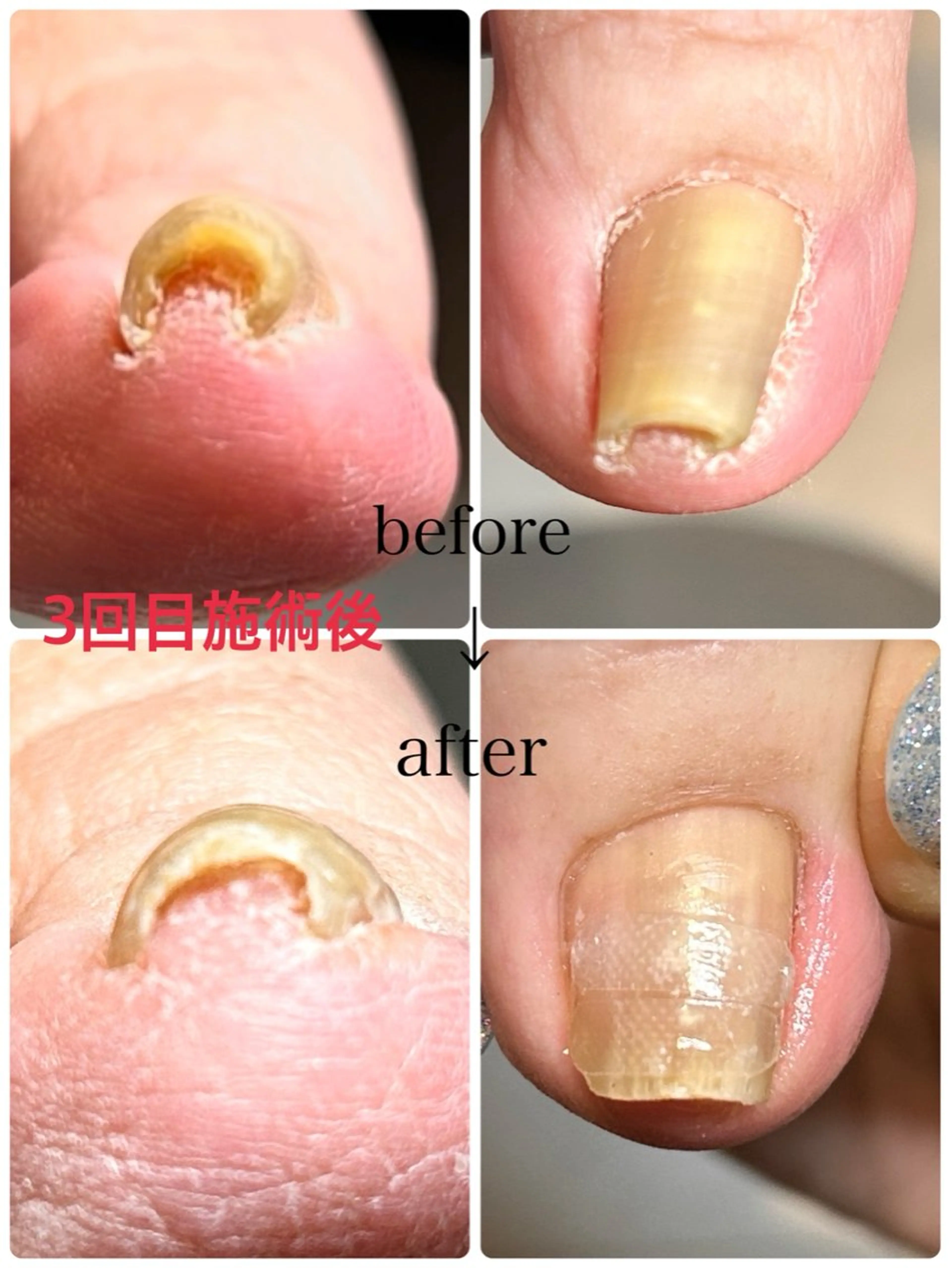 ネイル 長さ出し 持ち込み 春ネイル その他(ネイル) N.style所属・Ｎ. styleのネイルデザイン