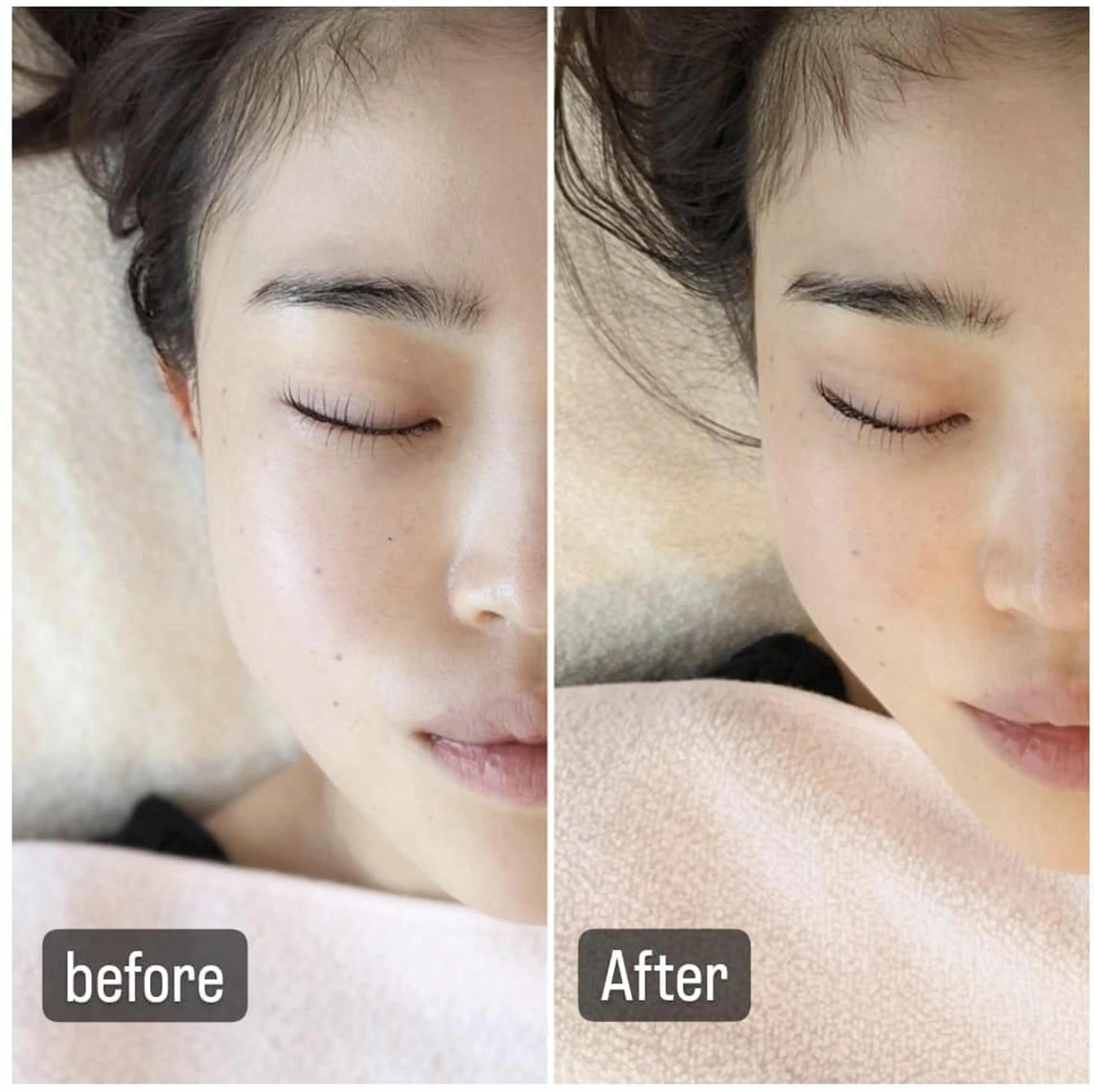 小顔美容鍼灸Acubelle Yakuin.【アキュベル薬院】所属・石川 真梨奈  美容鍼灸/アロマのエステ・リラクイメージ