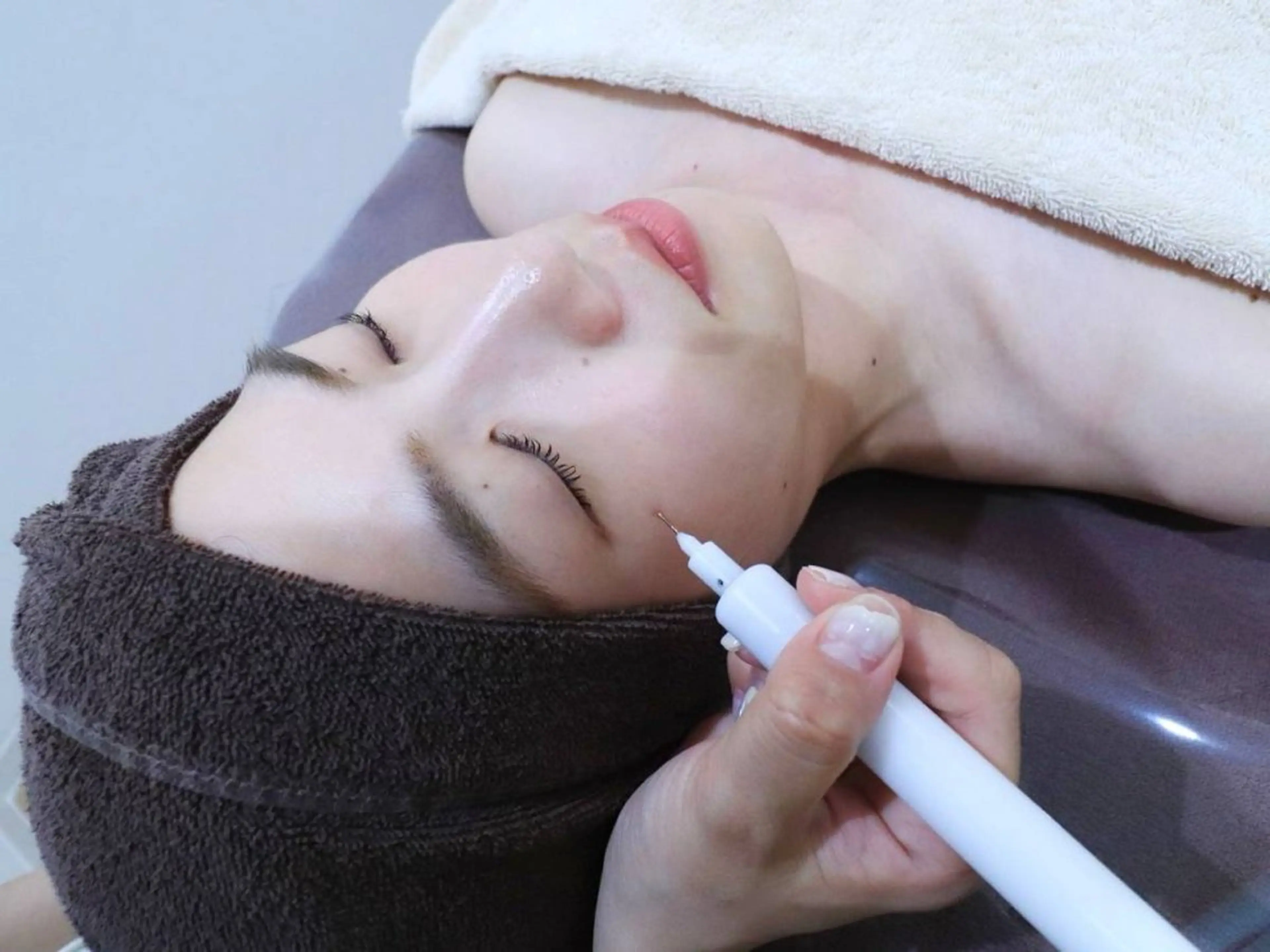 【初回体験】お肌に優しいシミデトックストリートメント2ミリ以下1個2,200円の写真