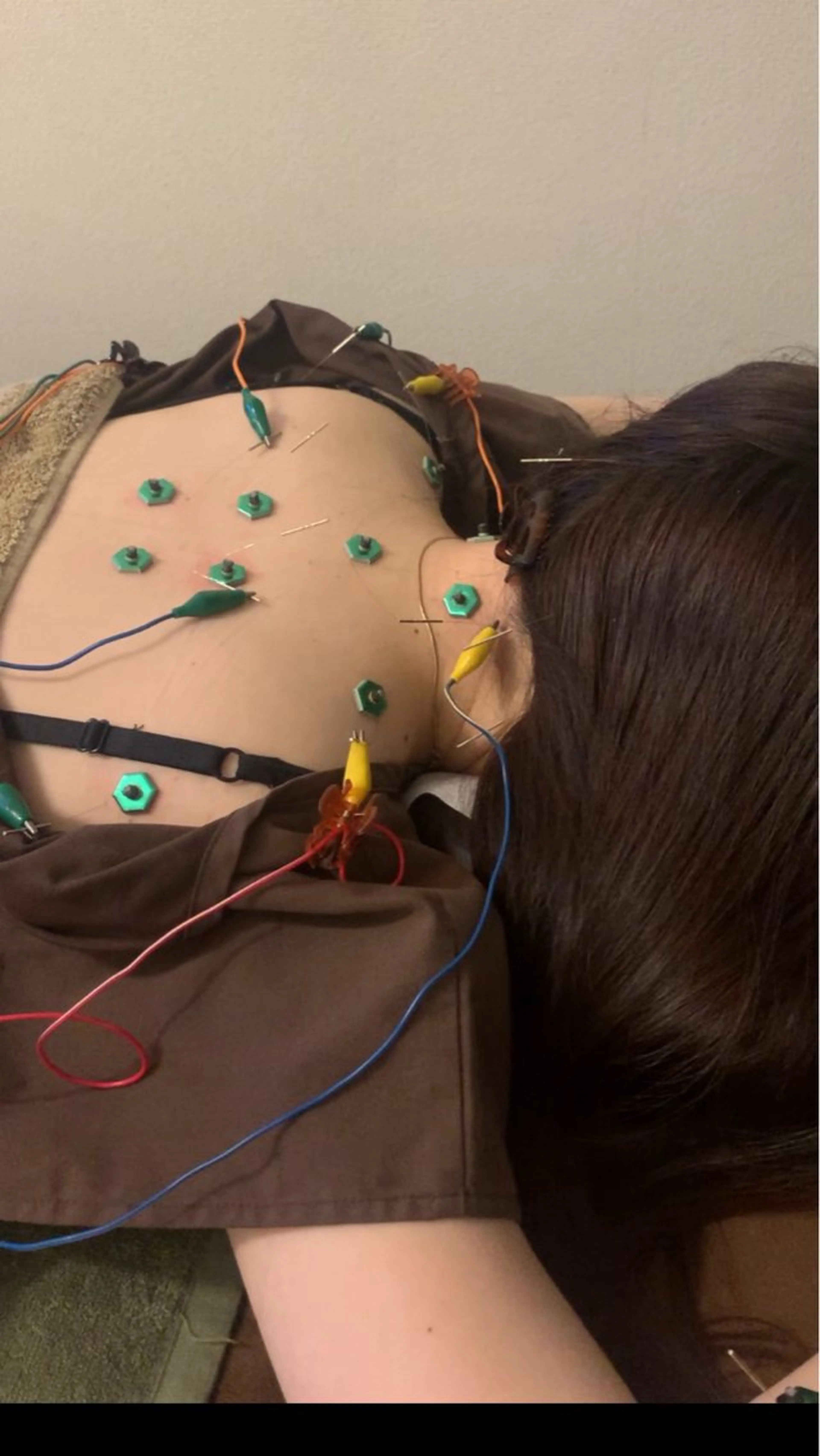 表参道鍼灸院K 美容鍼🔮ララピールのエステ・リラクイメージ