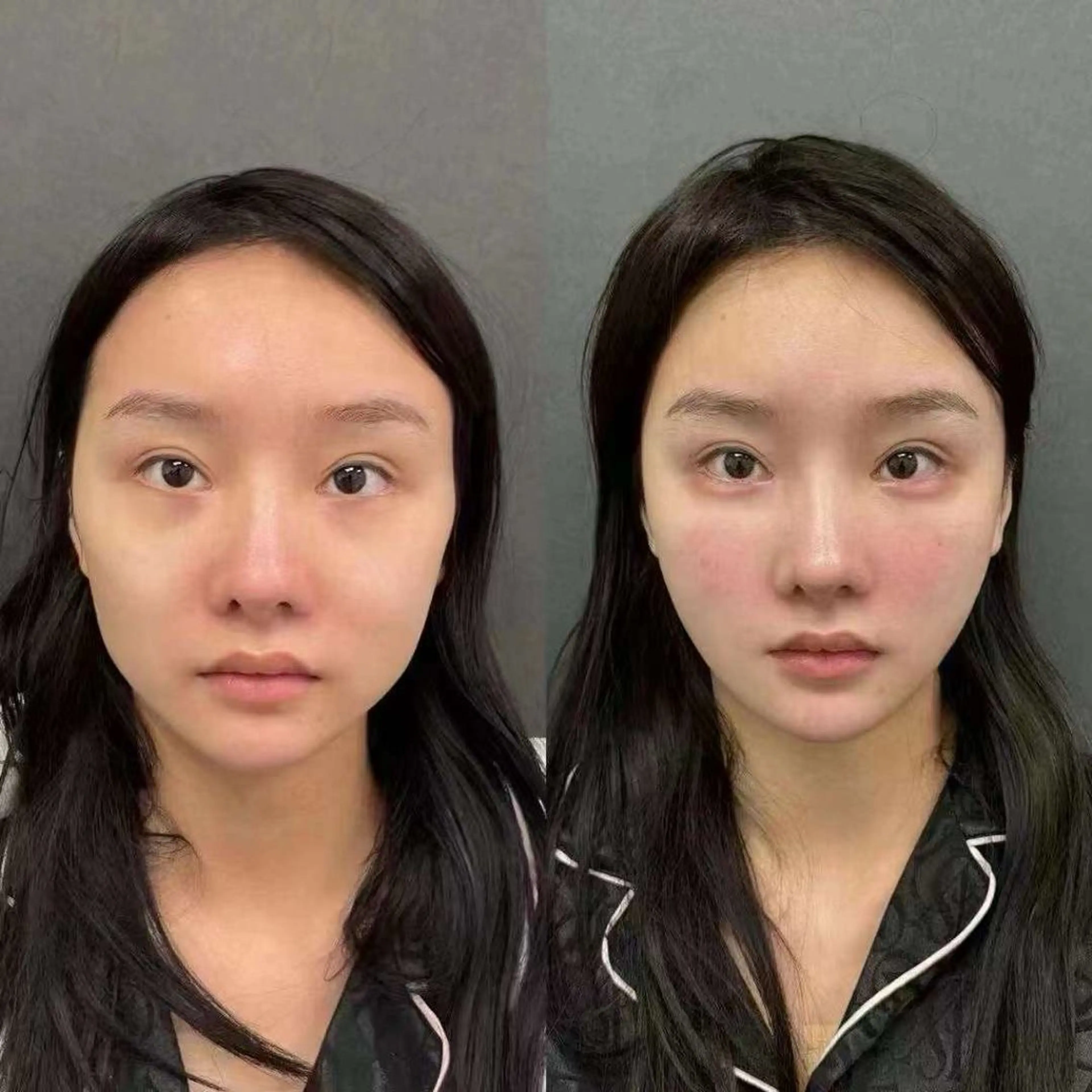 ネイル ブライダルネイル ホワイト エステ aliaハイフ&水光ジェットサロン所属・aliaハーブ水光店 エステティシャン募集のエステ・リラクイメージ