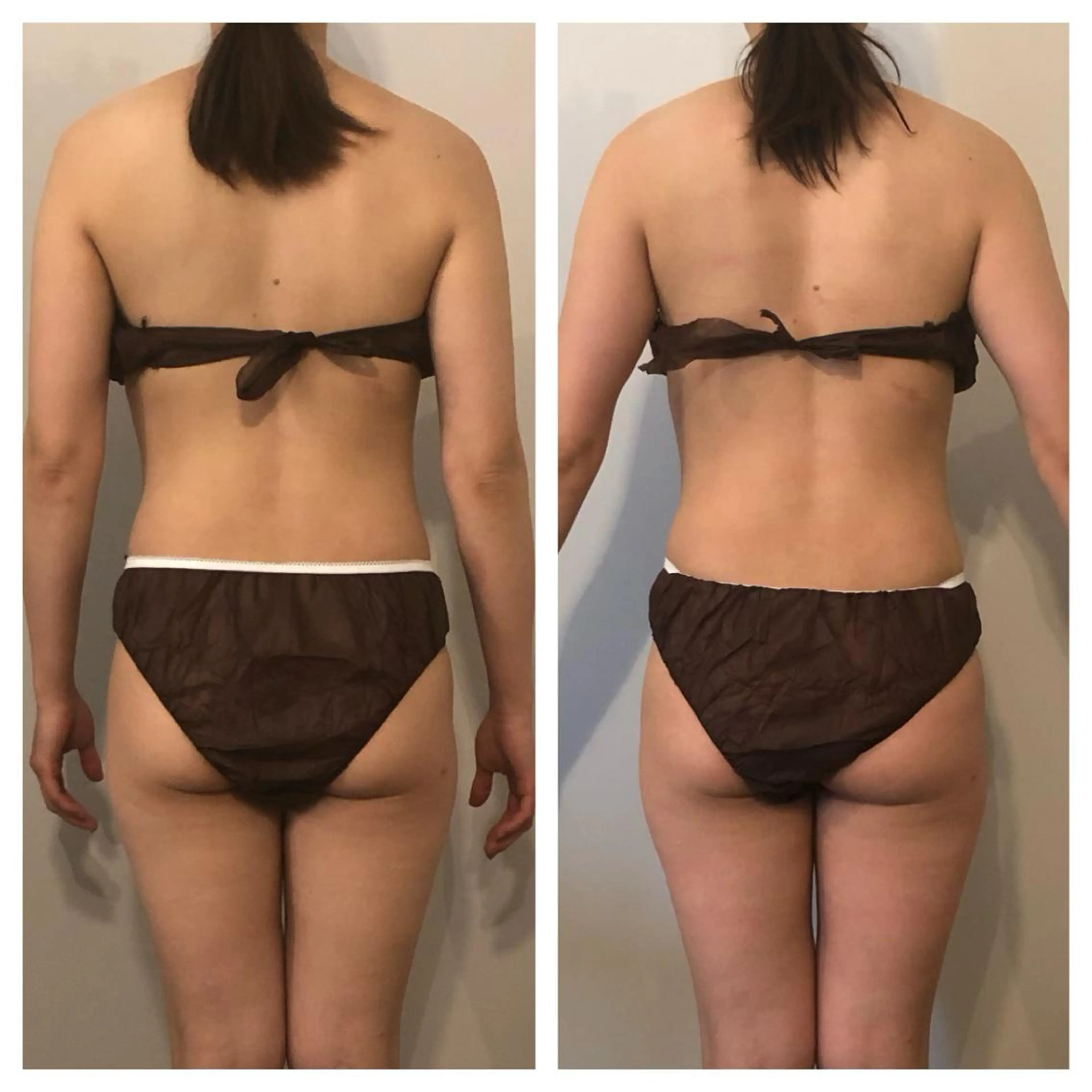 小顔・痩身専門店 Sunao所属・小顔.足痩せ整体 痩身天六Sunaoのその他イメージ