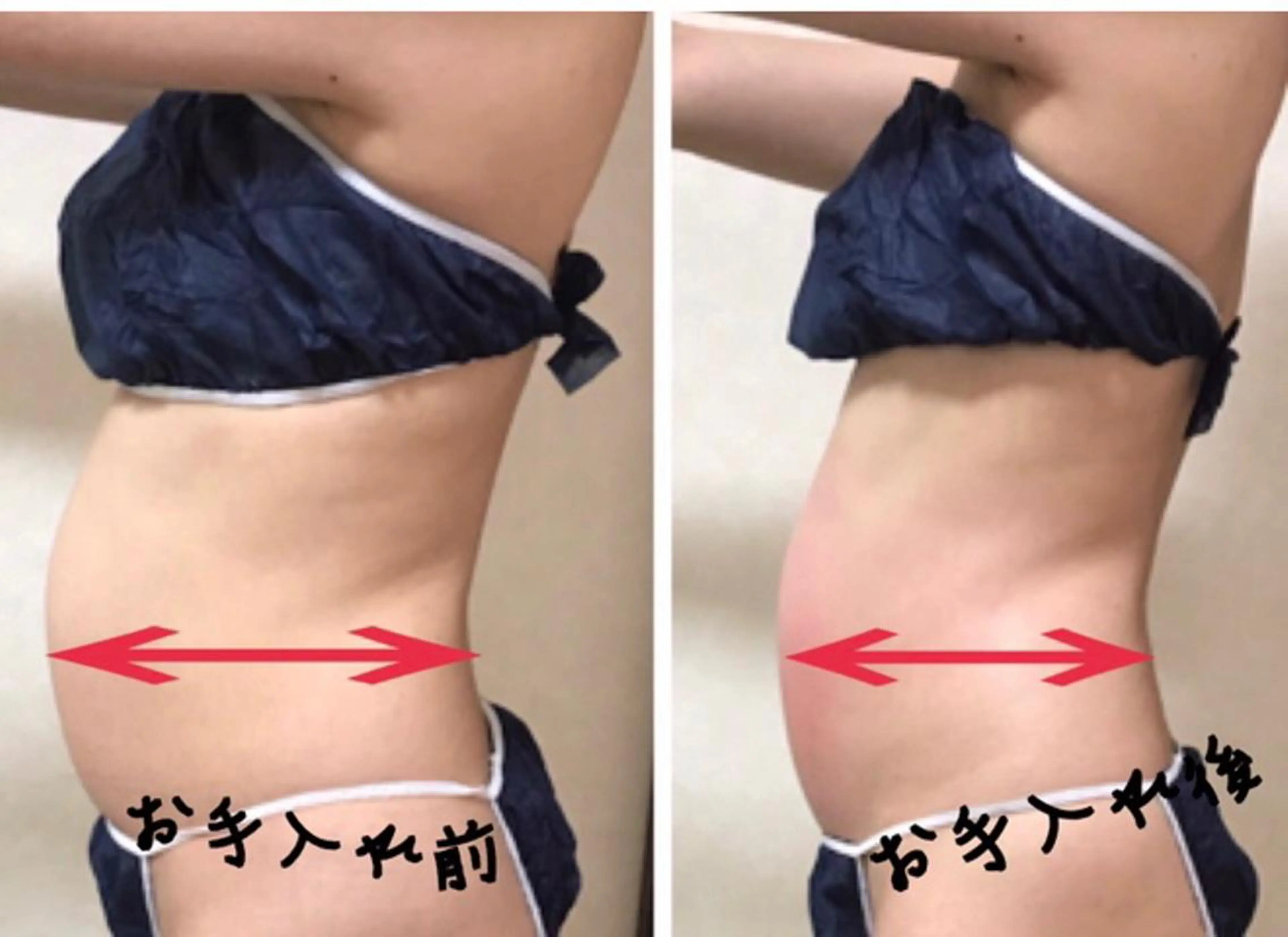 その他 ダイエット／脱毛 美顔／フォト／ハーブのその他イメージ