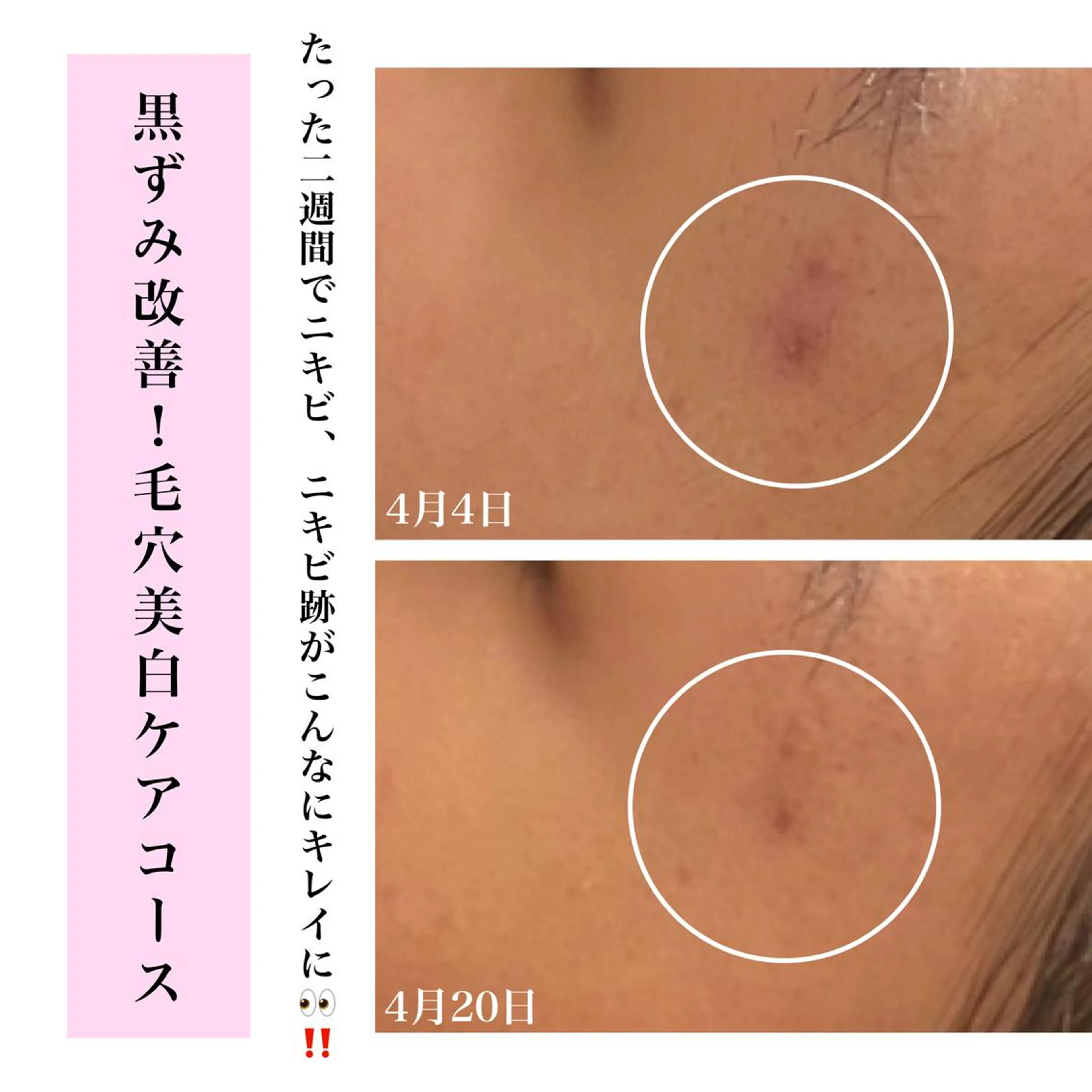 エステ リラク Bellesthe （ベルエステ）のエステ・リラクイメージ