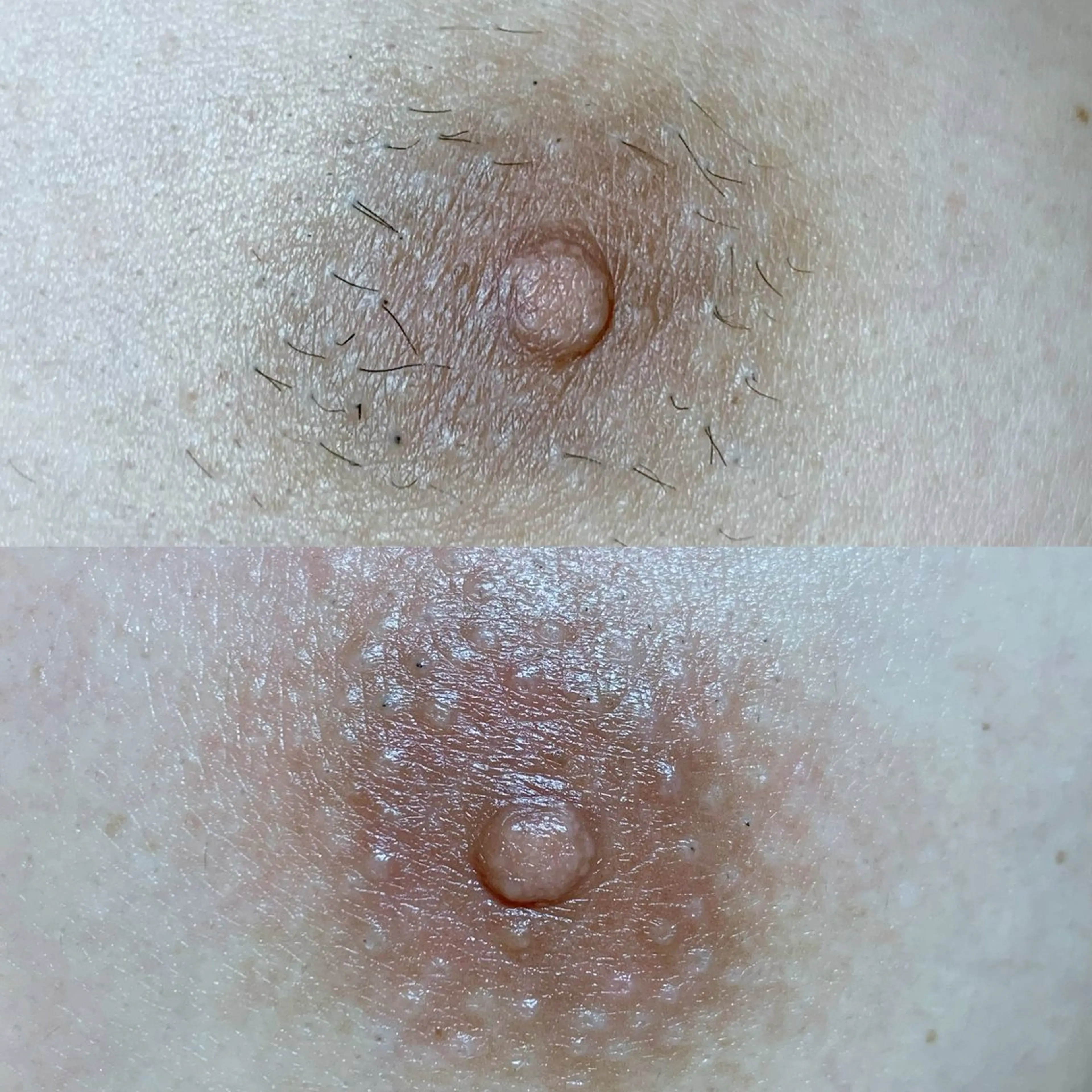 メンズ 脱毛 佐々木 ちゆきのエステ・リラクイメージ