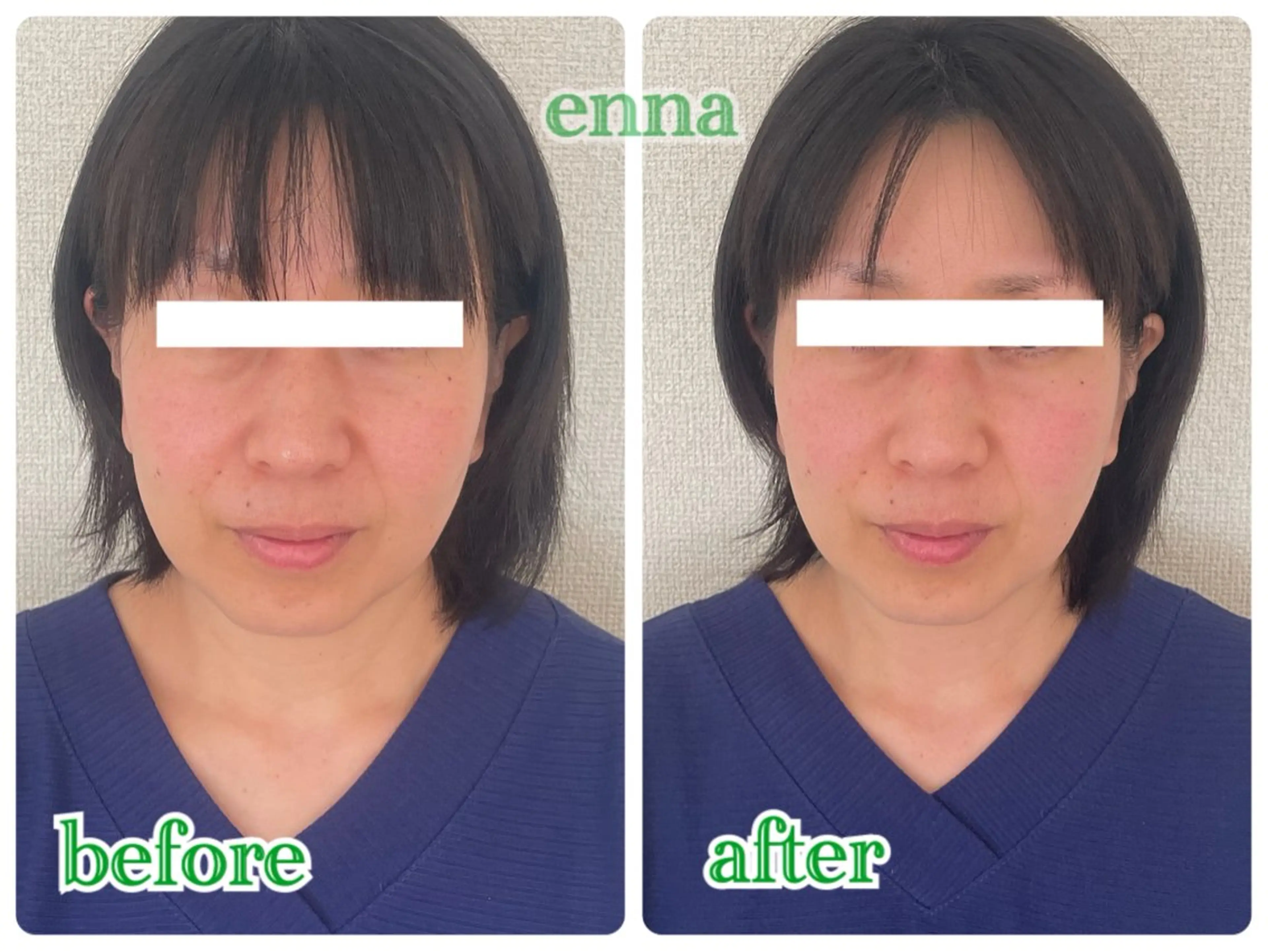 三上 笑里奈のエステ・リラクイメージ