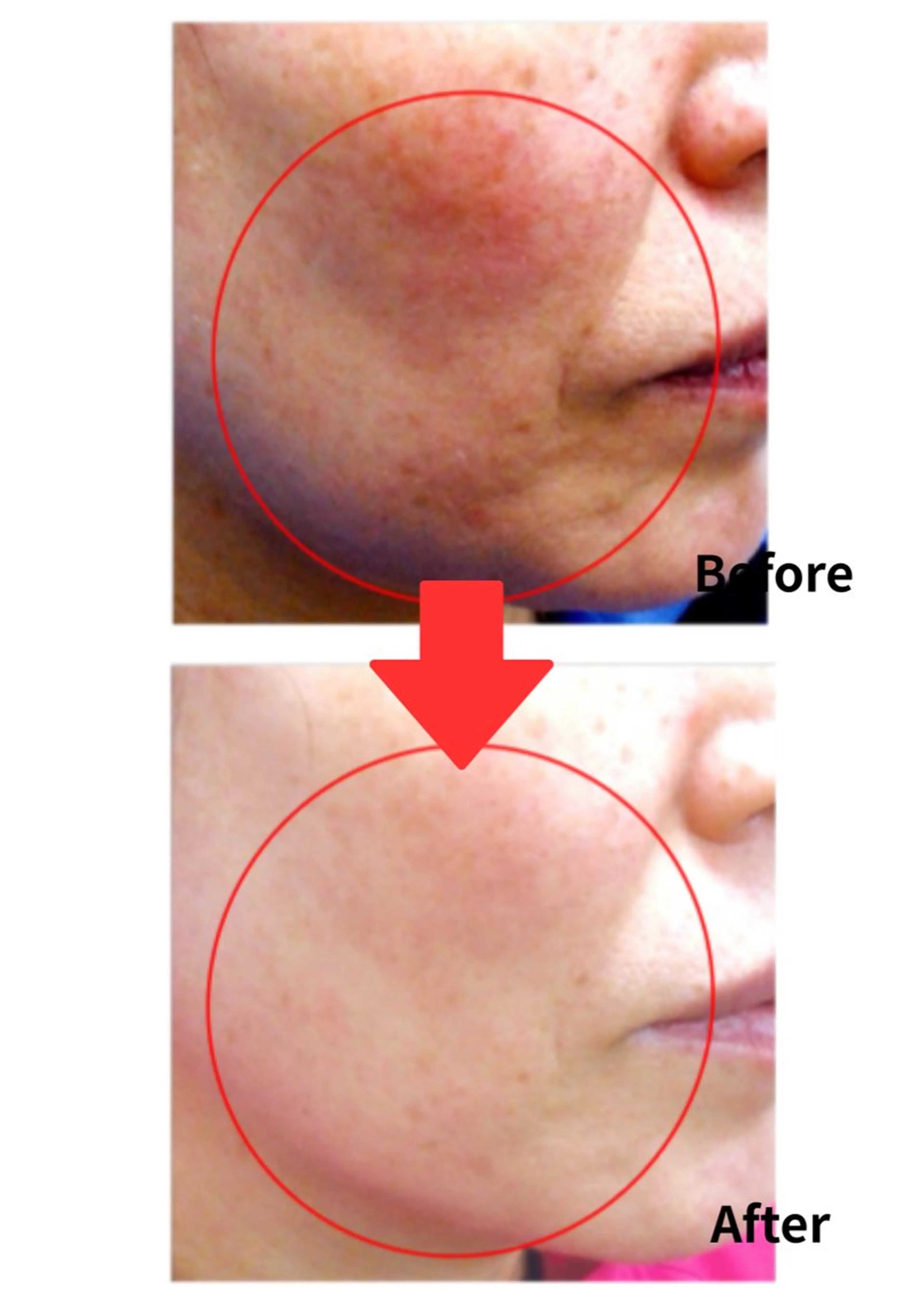 Belle White所属・本格痩身＊肌質改善＊ BelleWhiteのエステ・リラクイメージ