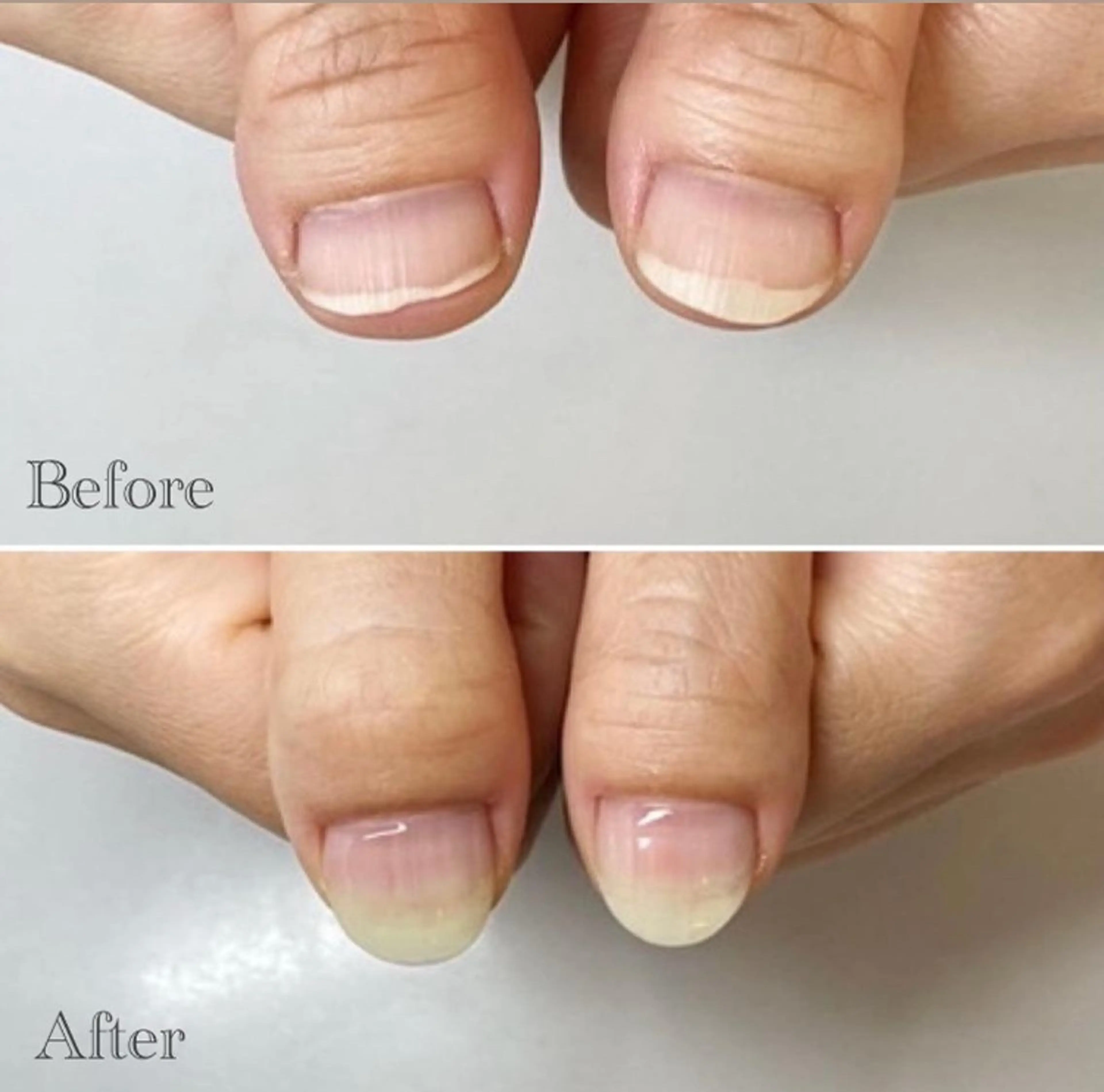 ネイル ネイルサロンアリューム所属・ネイルサロン アリュームのネイルデザイン