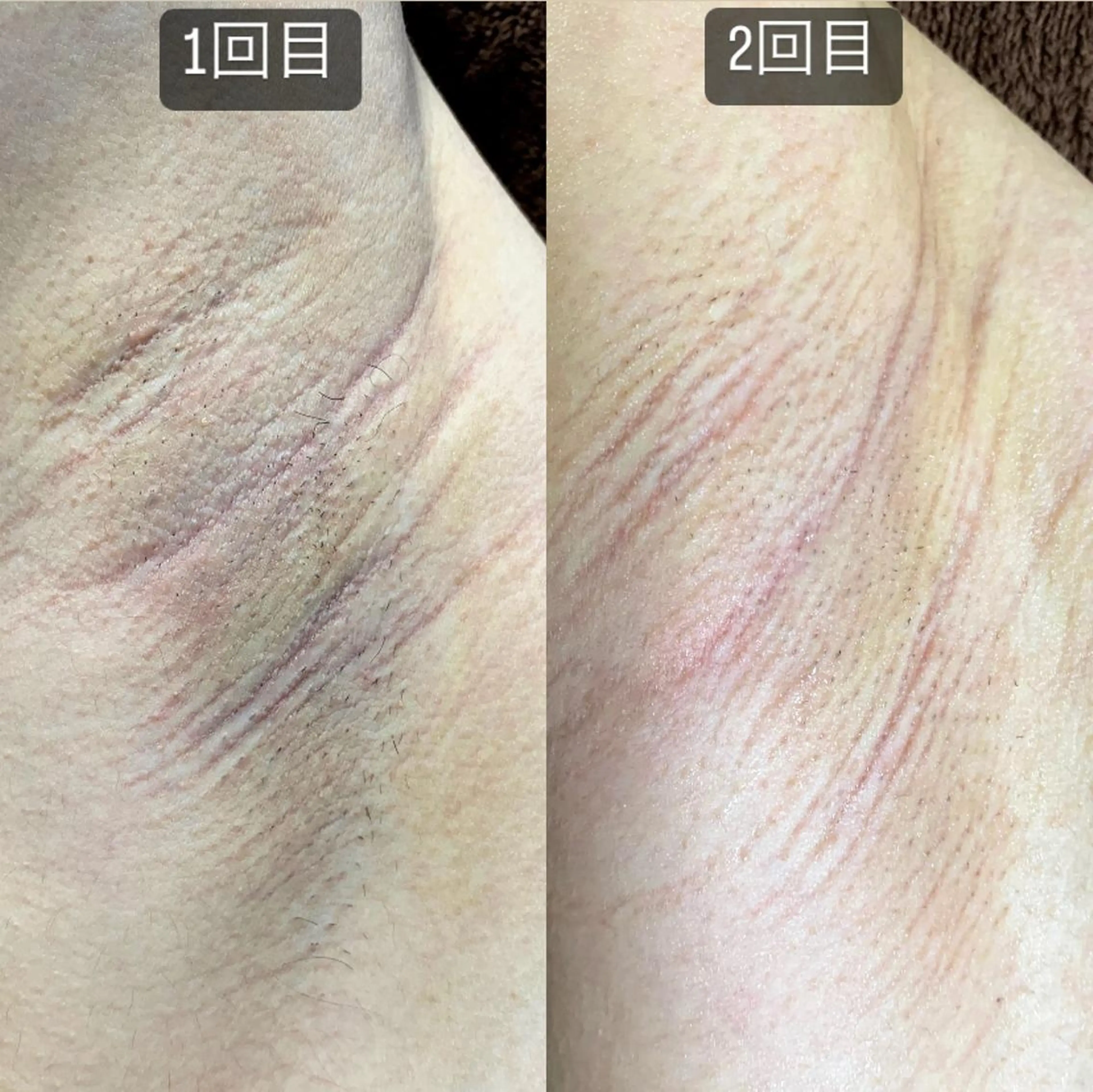 メンズ 脱毛SALON RaYNiCKのエステ・リラクイメージ