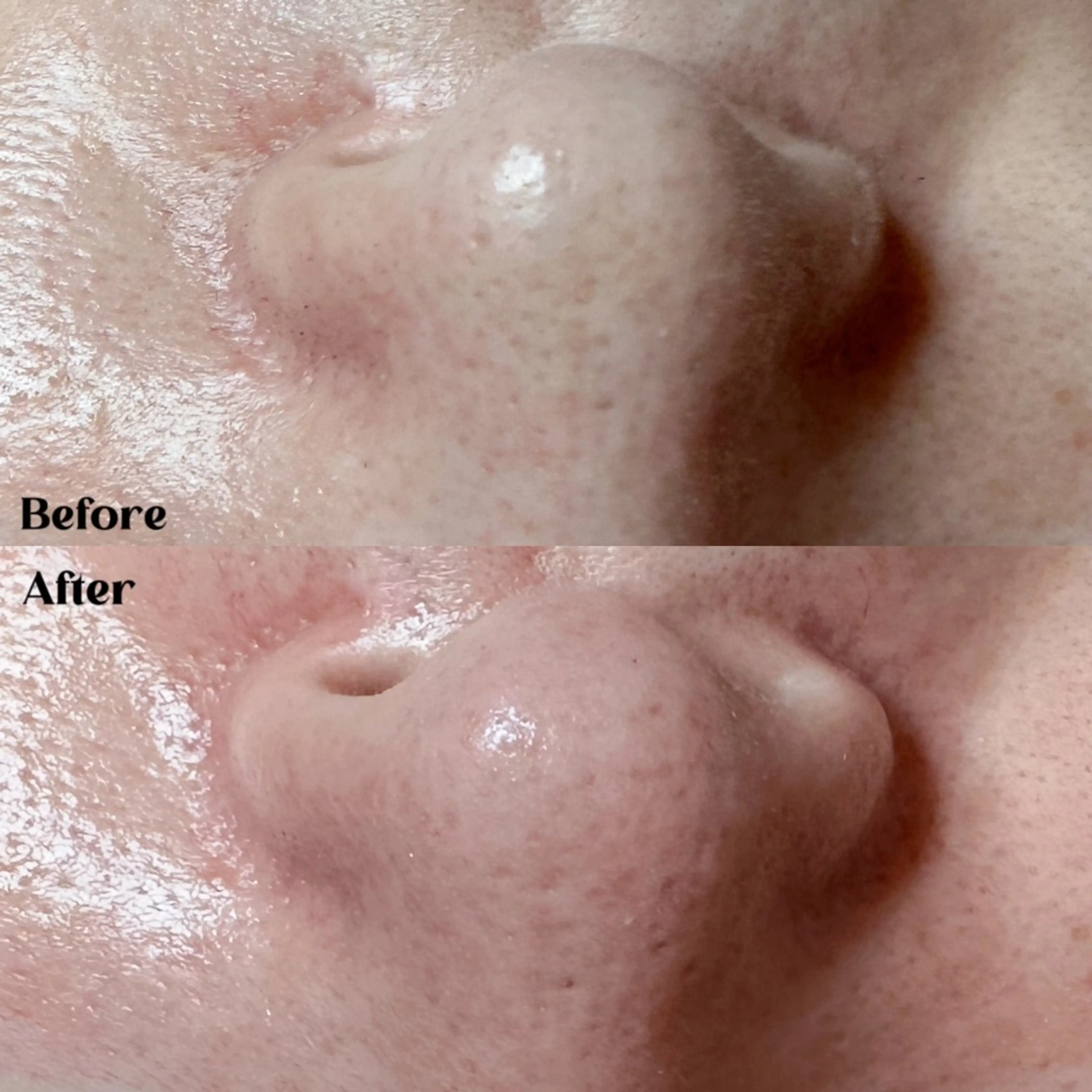 Hit. シュガーリング豊橋のエステ・リラクイメージ