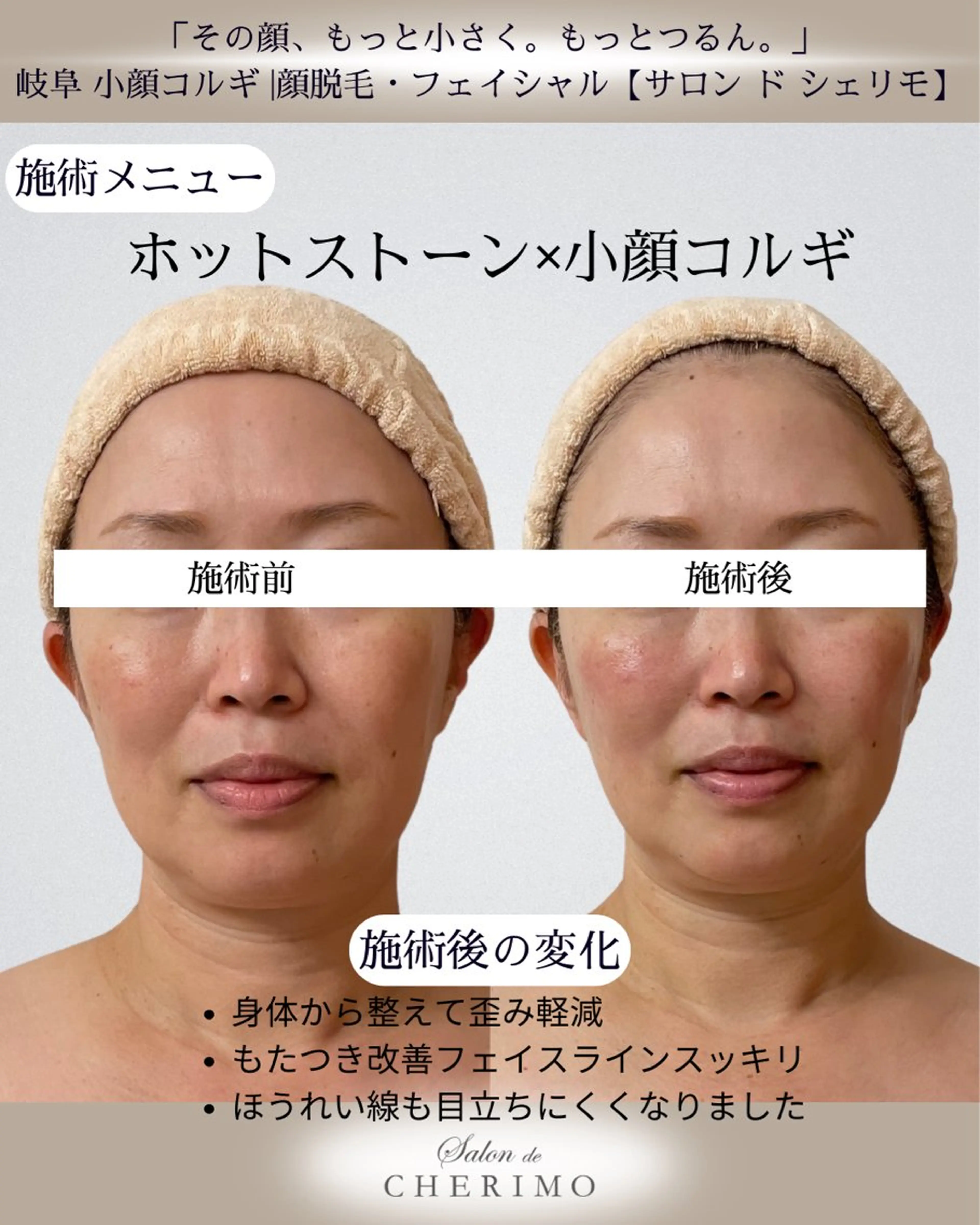 エステ リラク 林 恵利佳のその他イメージ