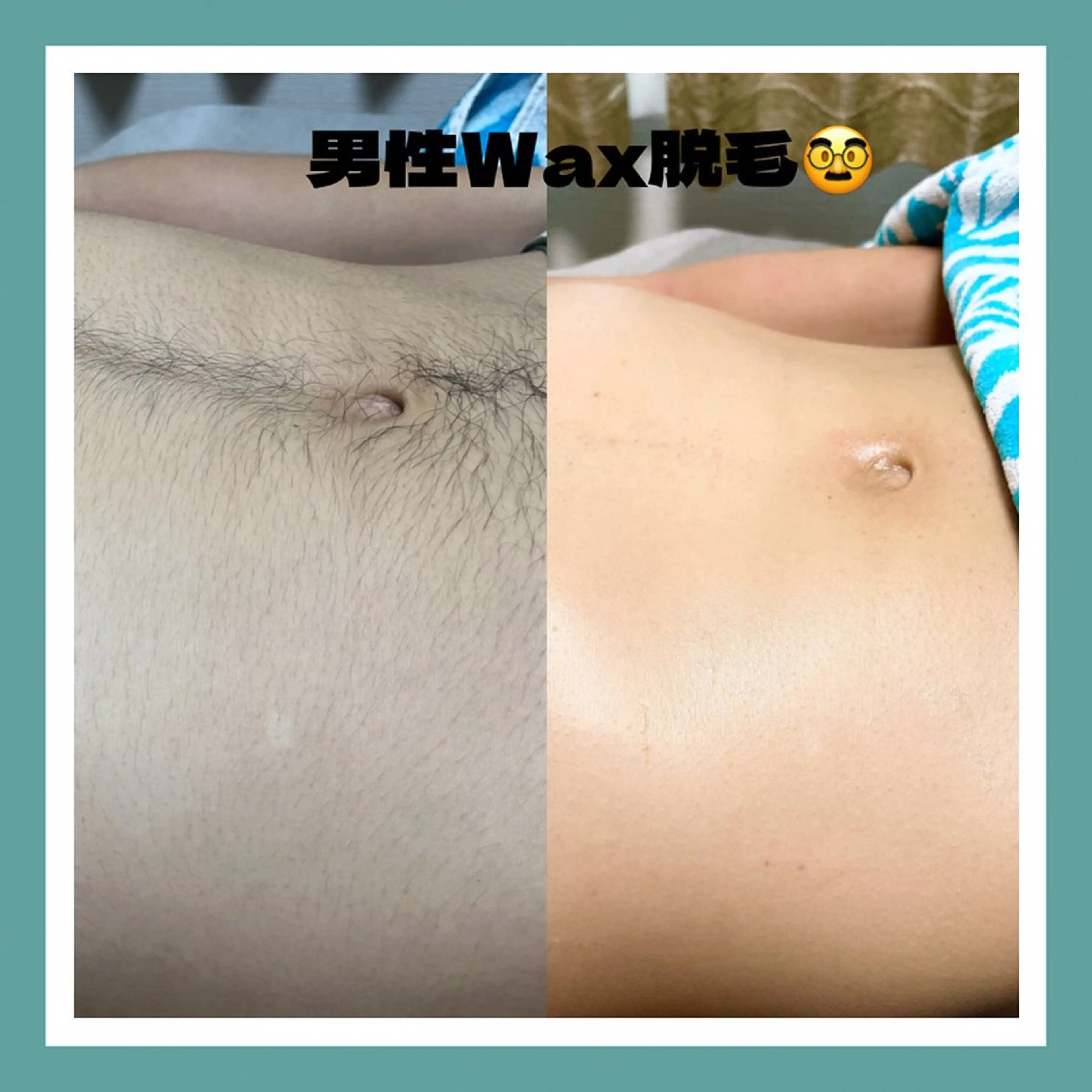 メンズ 脱毛 【光＆WAX脱毛】セラヴィプライベートサロン（メンズ・キッズも可）所属・kaise makiのエステ・リラクイメージ