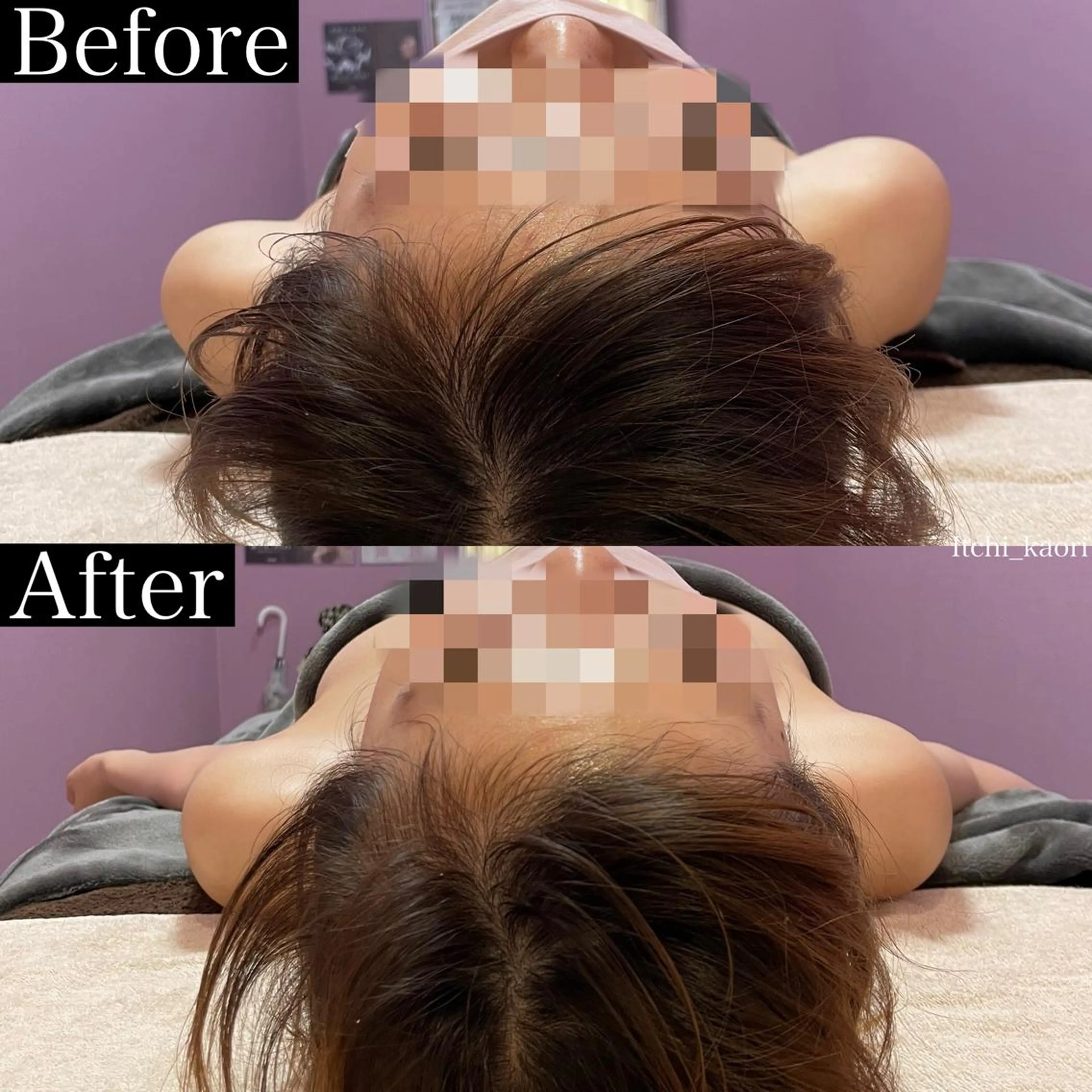 【Set】腕からねじれを解消し肩首の不調改善トリムハンドと頭部の硬さを解消し自律神経まで整えるトリムヘッドのセットです♪の写真