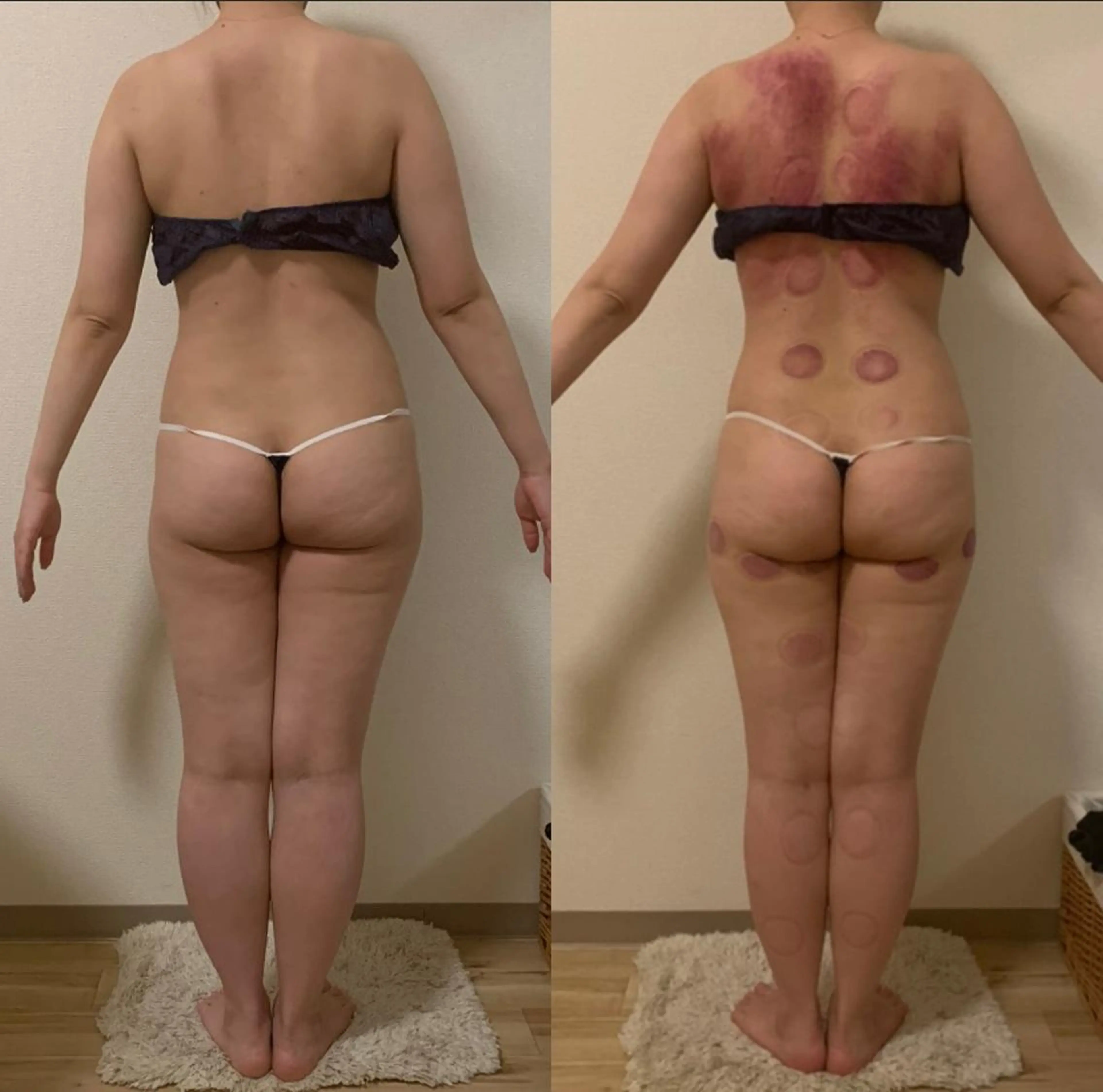 a  room salonのエステ・リラクイメージ