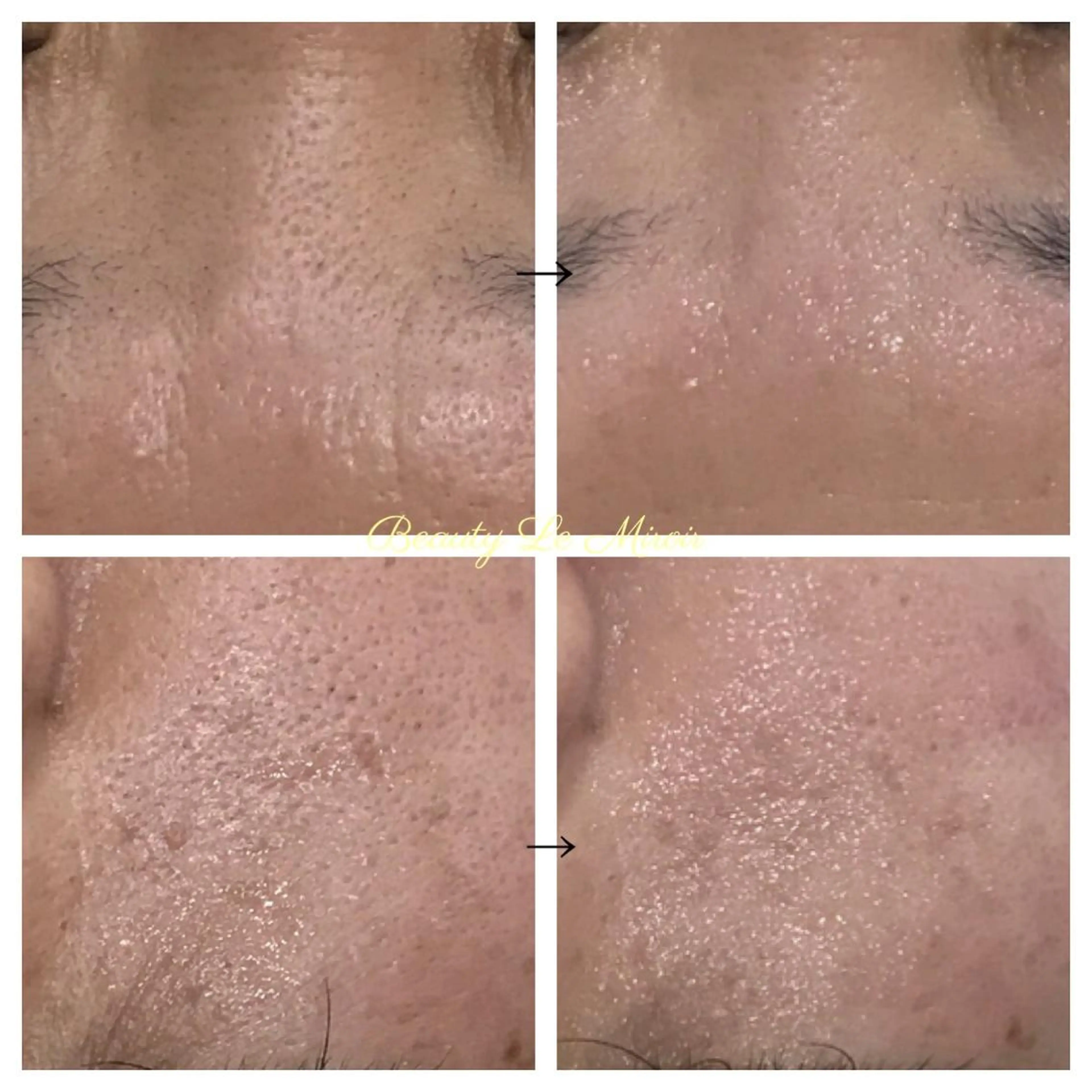 ビューティー ミロワールのエステ・リラクイメージ