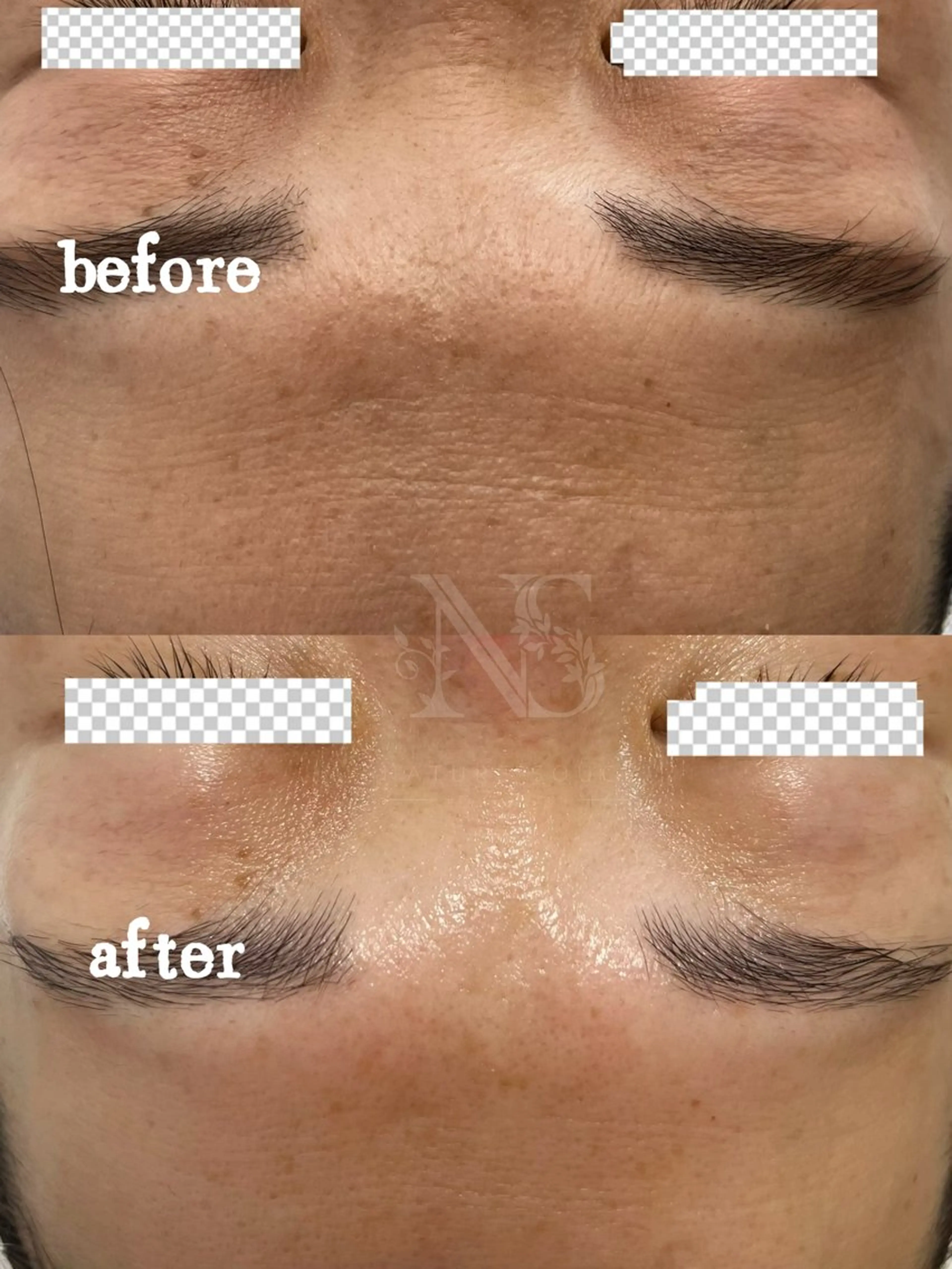 Nature Souce毛穴専門店のその他イメージ