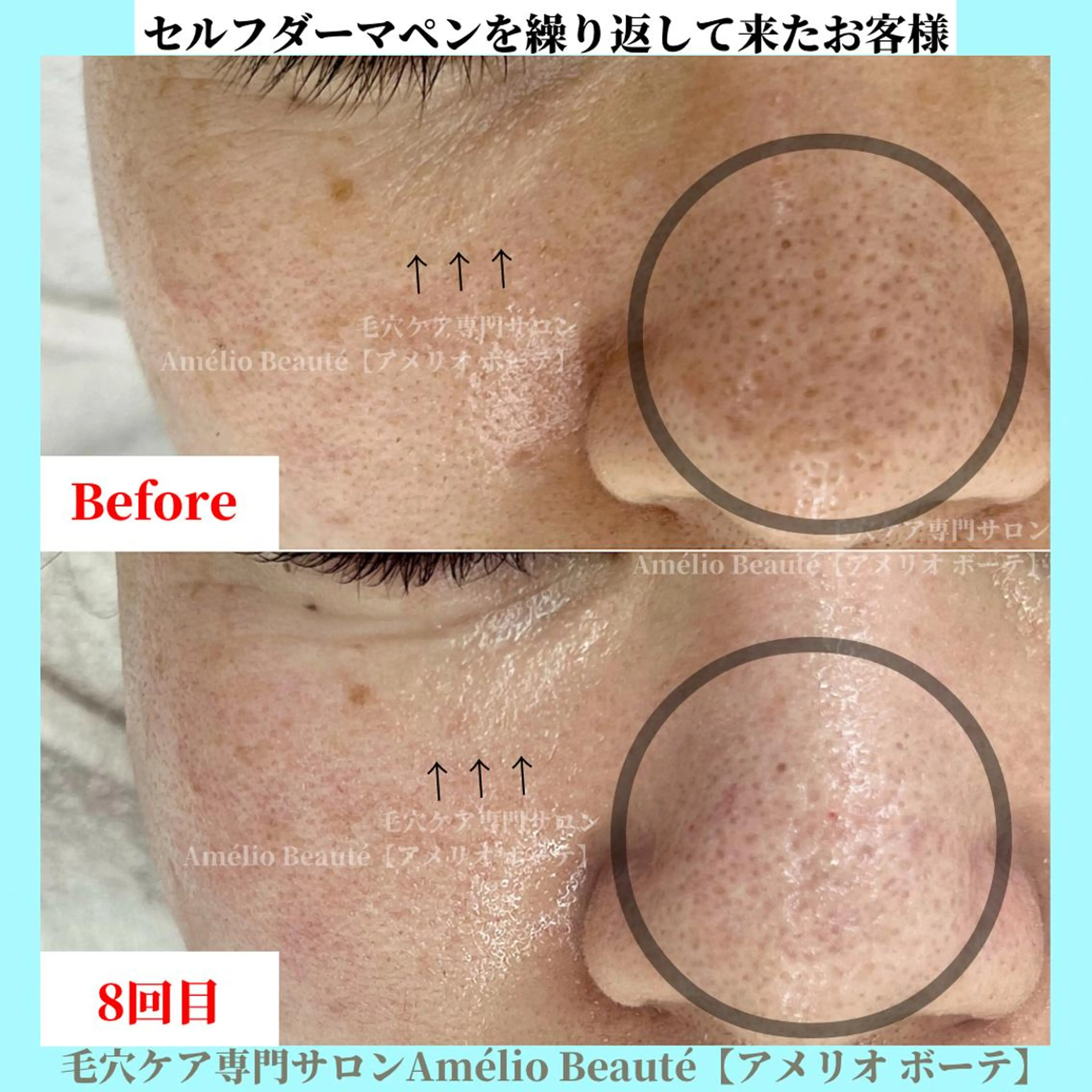 毛穴ケア専門サロン Amélio Beauté所属・毛穴ケア専門サロン アメリオボーテのその他イメージ