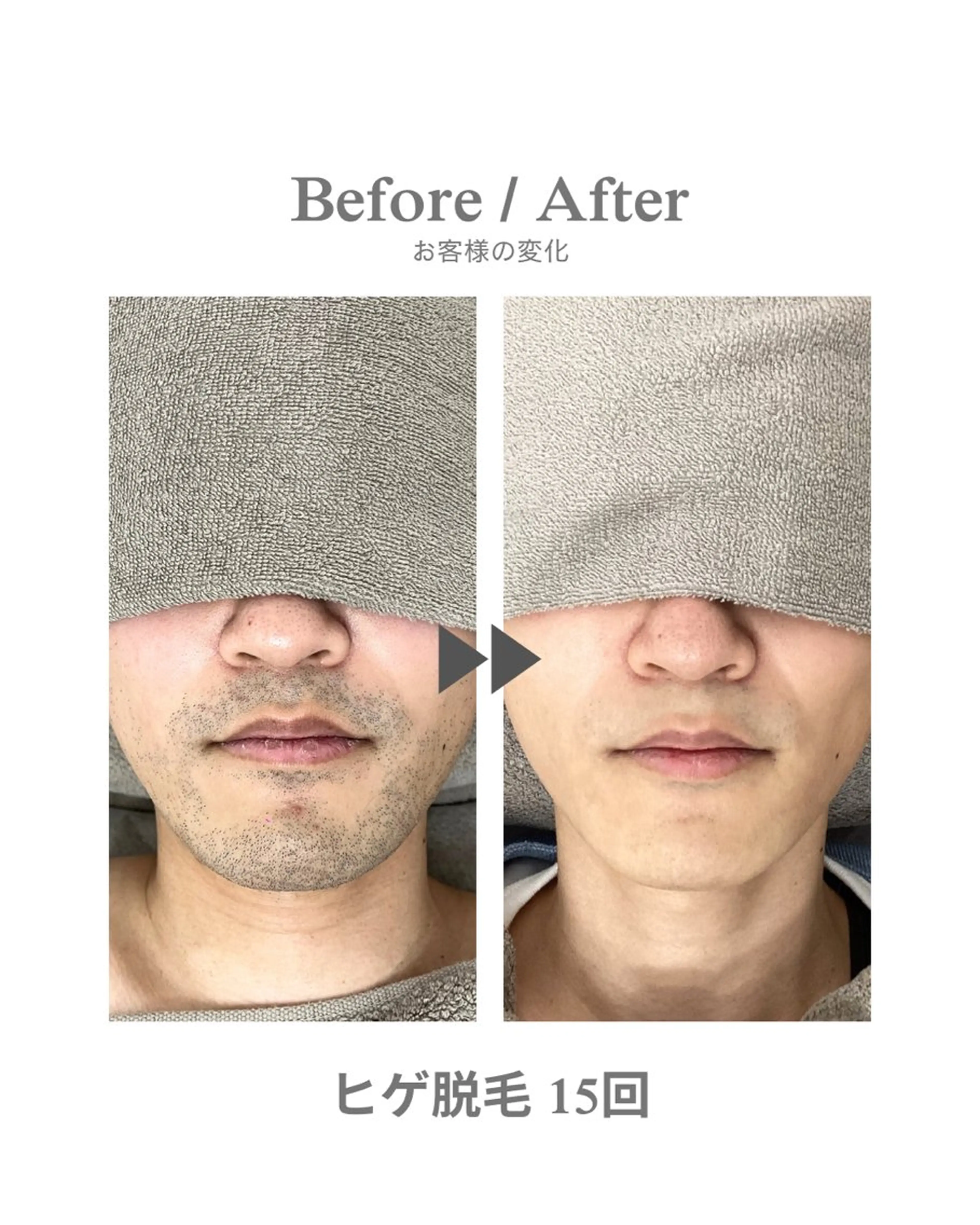 メンズ 脱毛 エステサロンNarcis〜ナルシス〜所属・脱毛＆痩身エステ Narcisのエステ・リラクイメージ