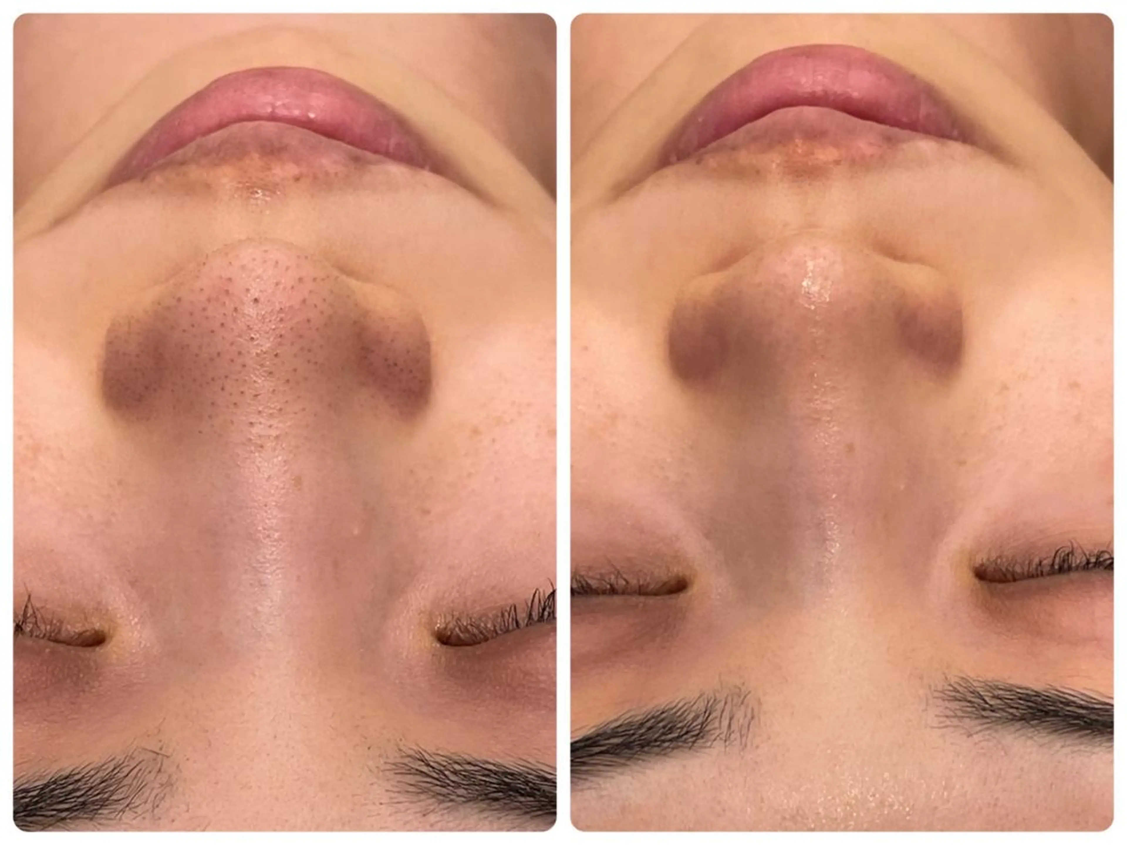 ♡RAYVIS♡ 名古屋店　神田のエステ・リラクイメージ