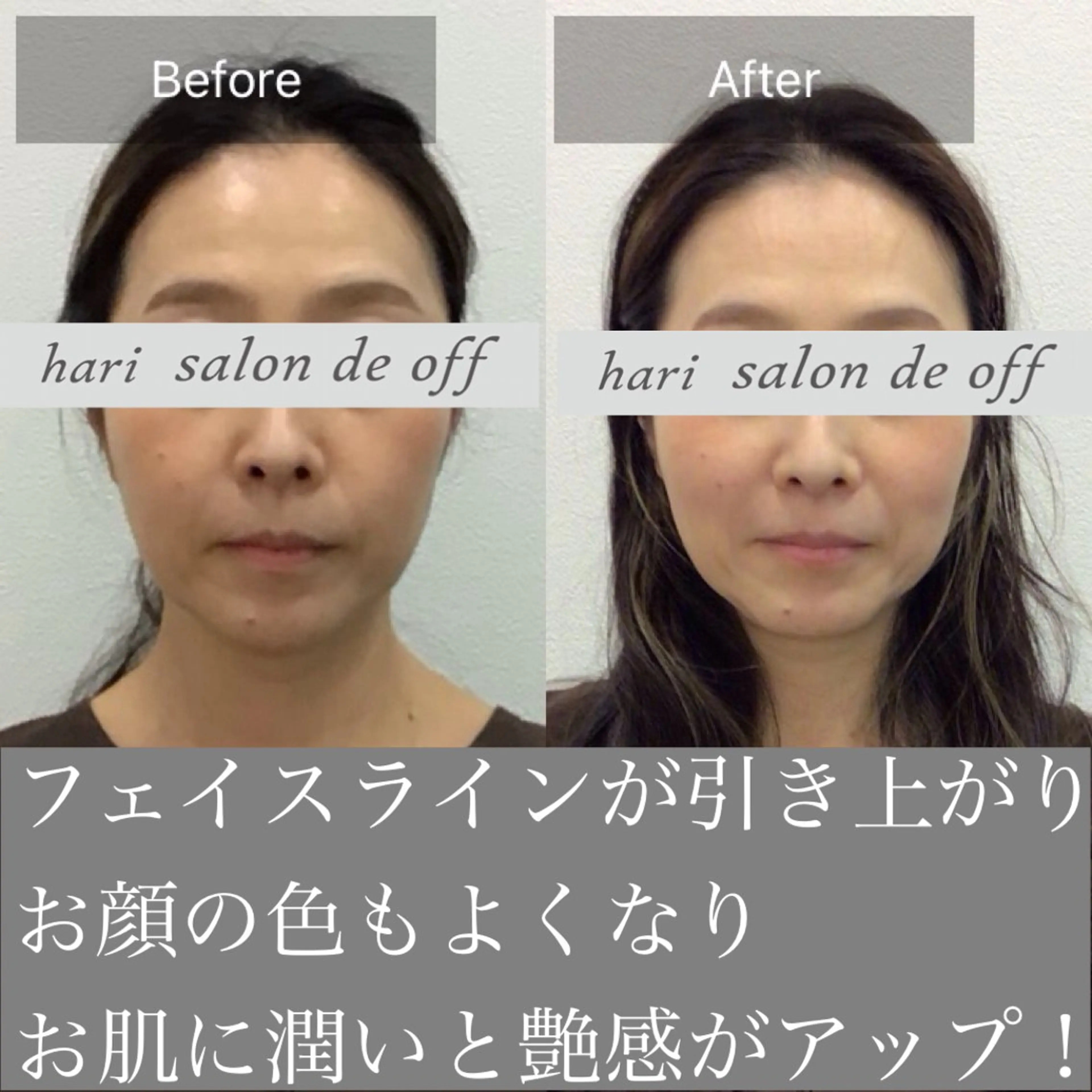 エステ リラク 整体×美容鍼灸 鍼灸師Miyanoのエステ・リラクイメージ