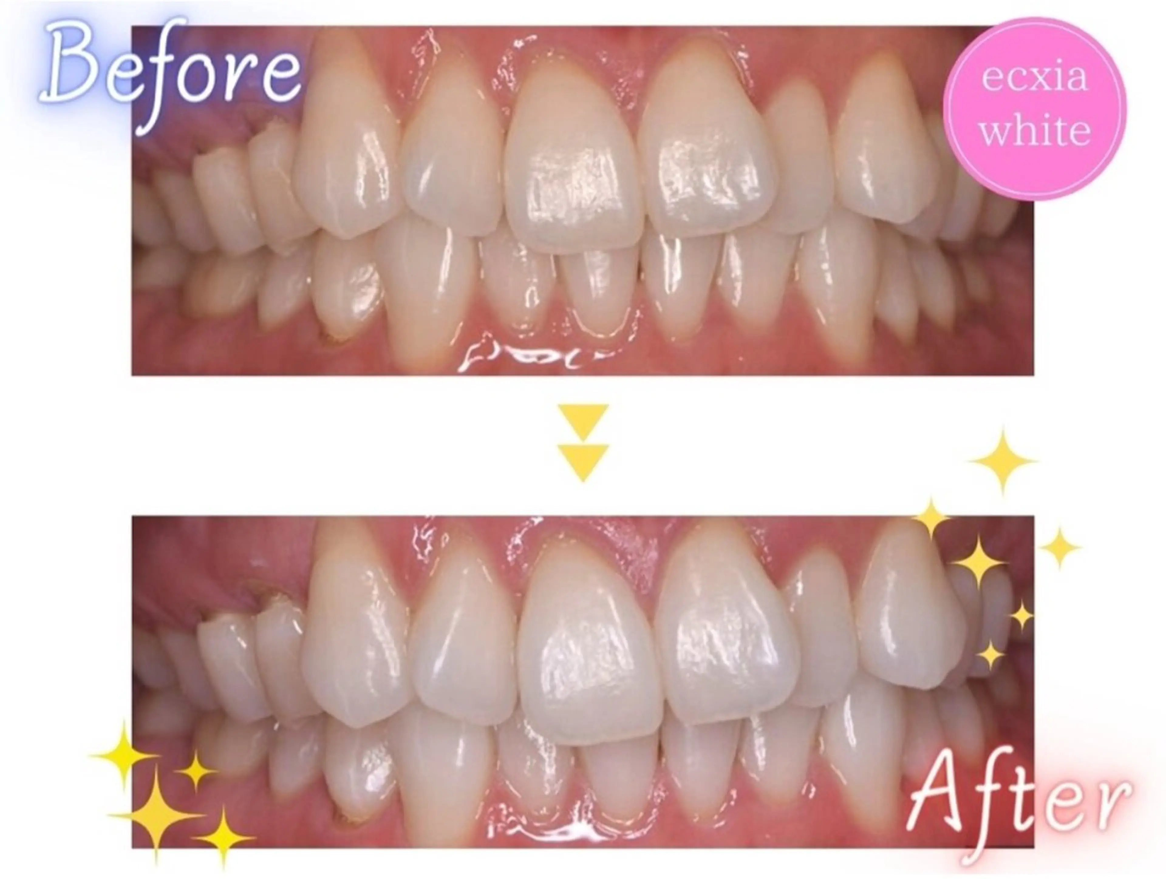 エクシアホワイトニング伊勢店所属・セルフホワイトニング エクシア伊勢店のその他イメージ