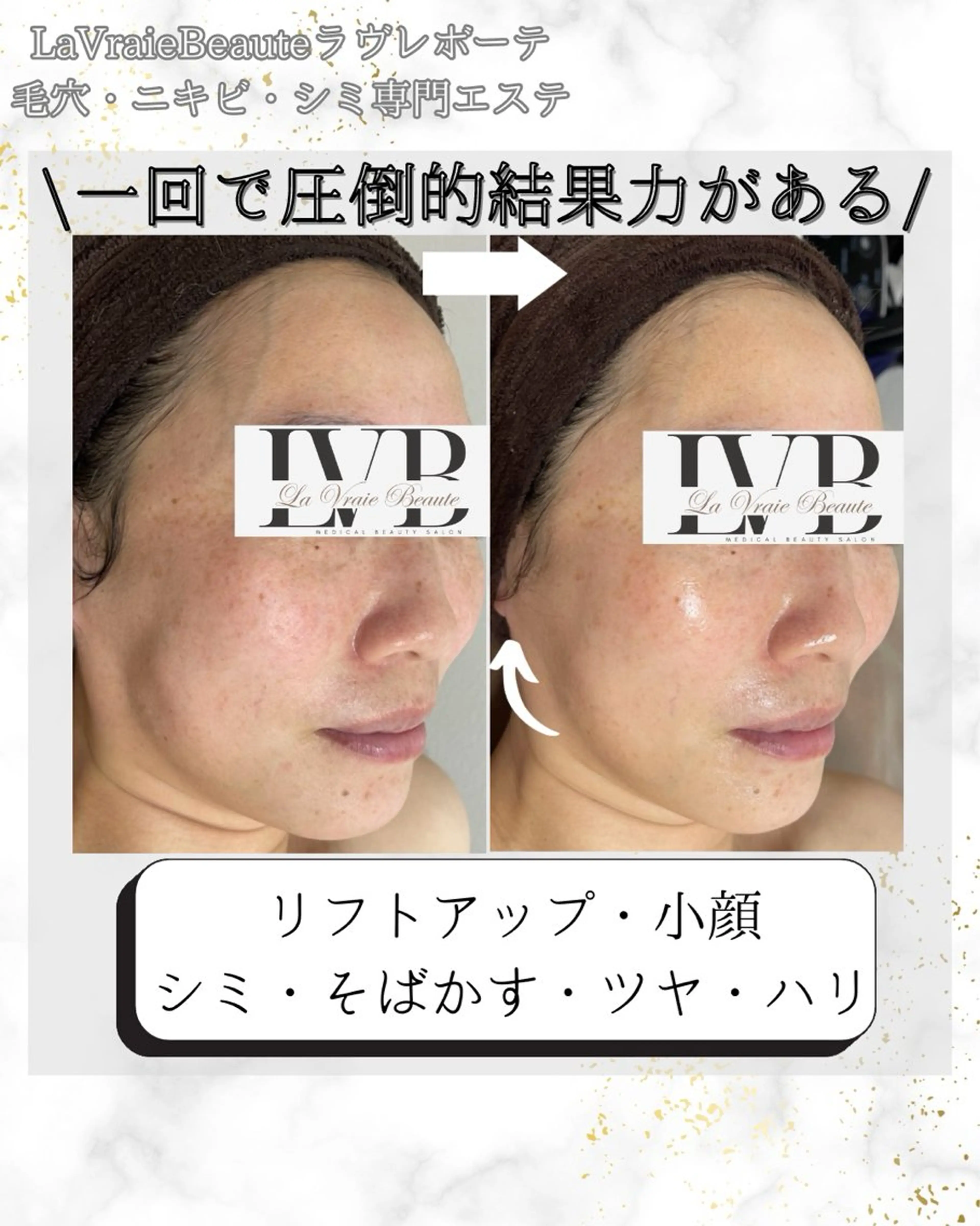 岸和田　肌改善 顧問医師提携サロンのエステ・リラクイメージ