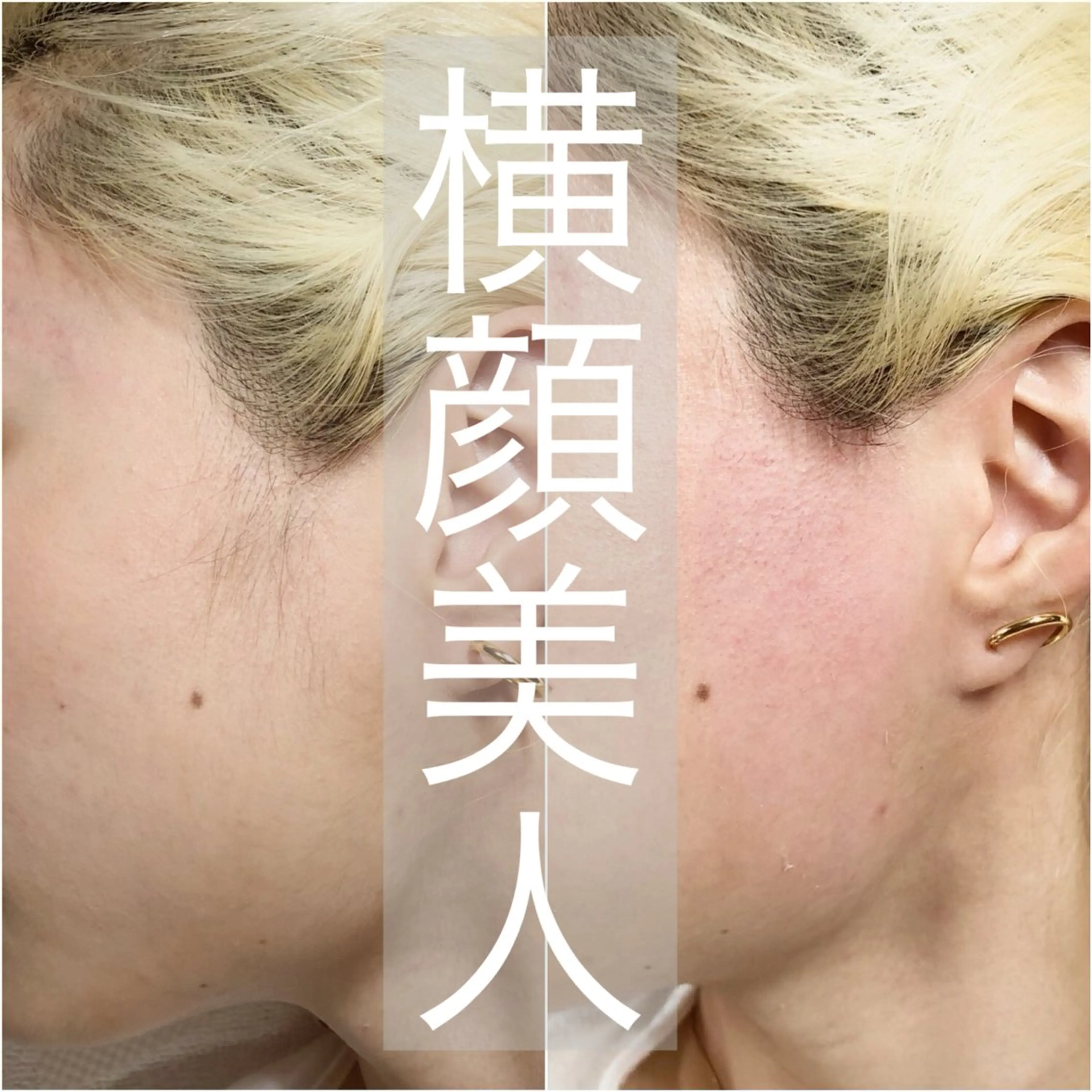 ツヤ肌フェイシャルワックス(ヘッドマッサージ付き) 眉毛デザインは含まれませんの写真