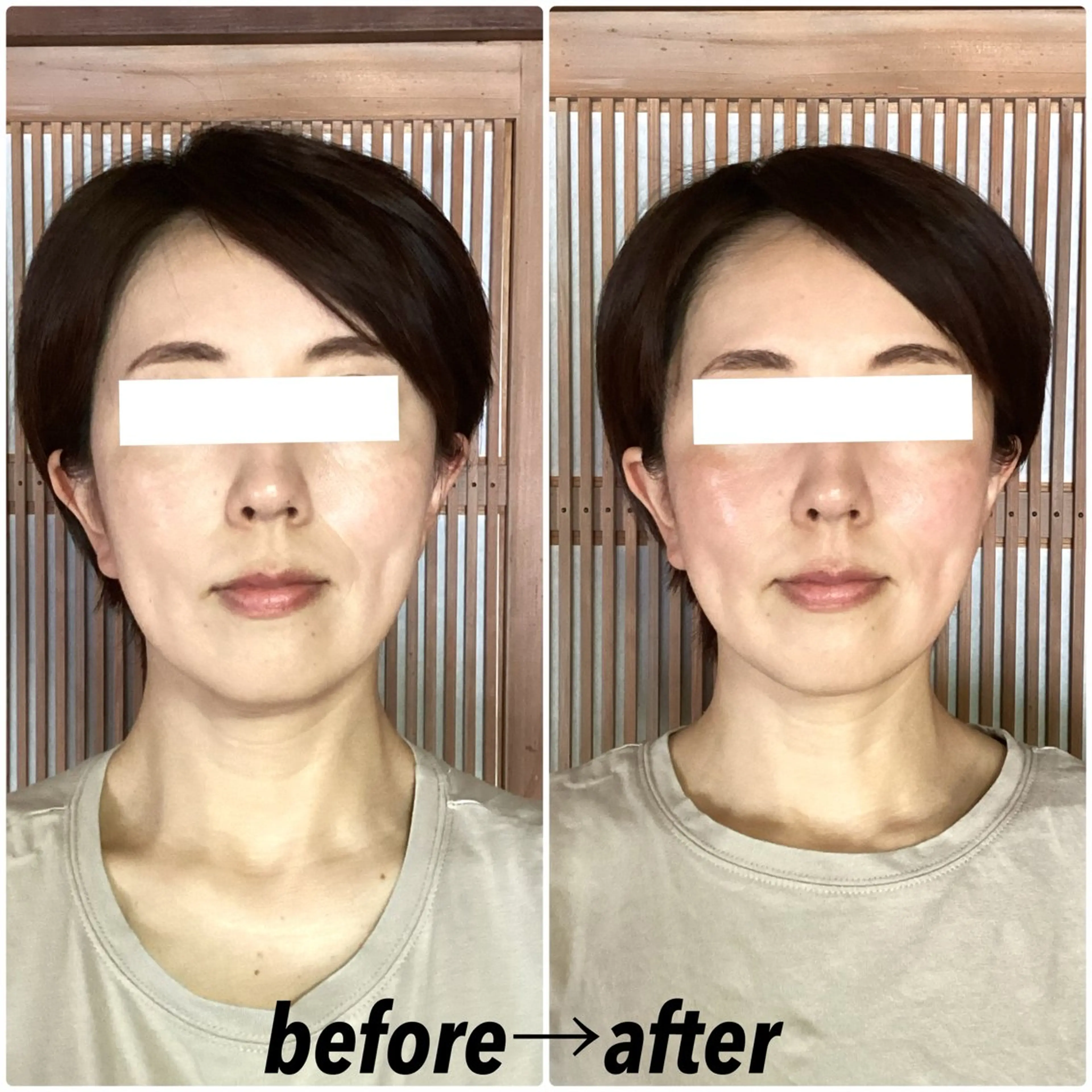 エステ リラク ルコナビューティ所属・小顔・歪み専門　井元 朋子のエステ・リラクイメージ