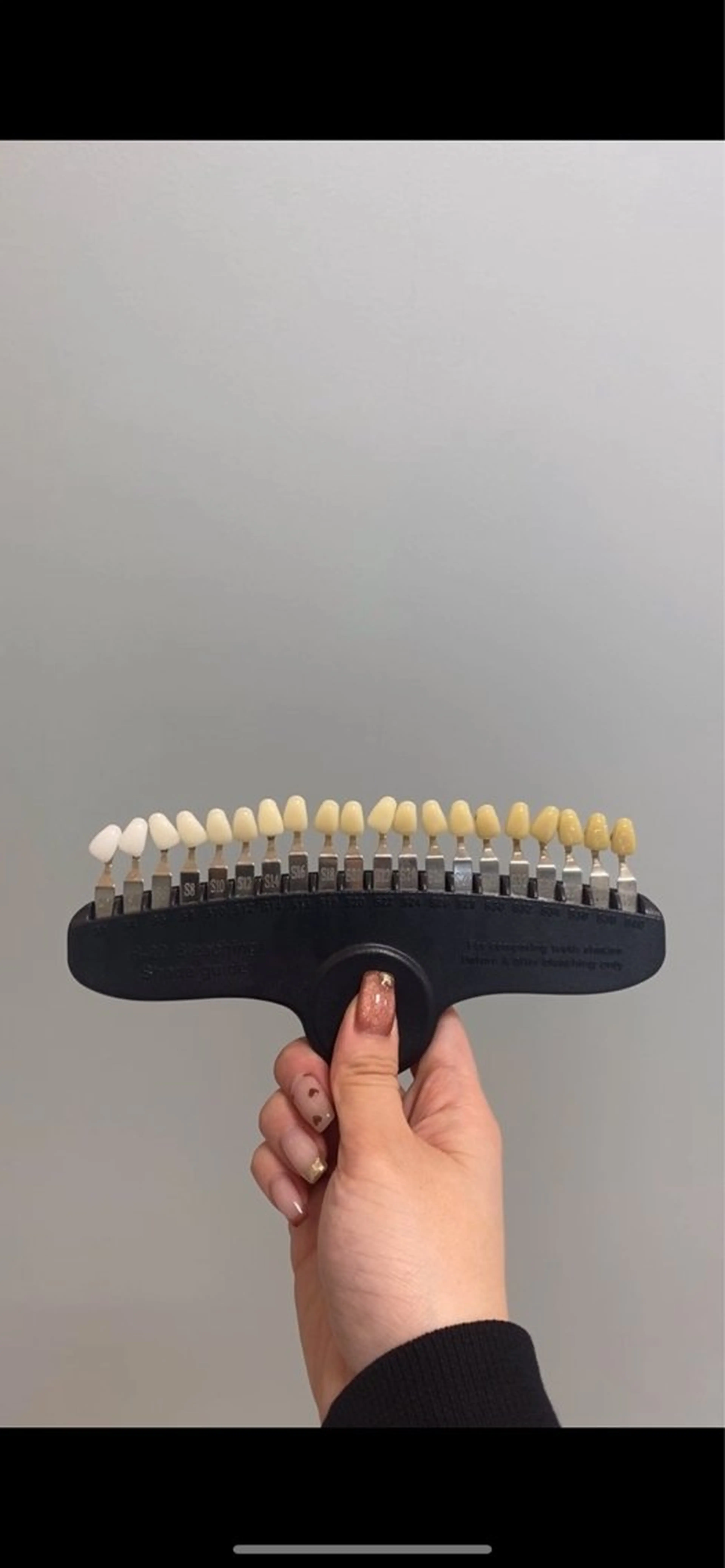 メンズ その他 エクシアホワイトニング草津店所属・nanami -ホワイトニングのその他イメージ