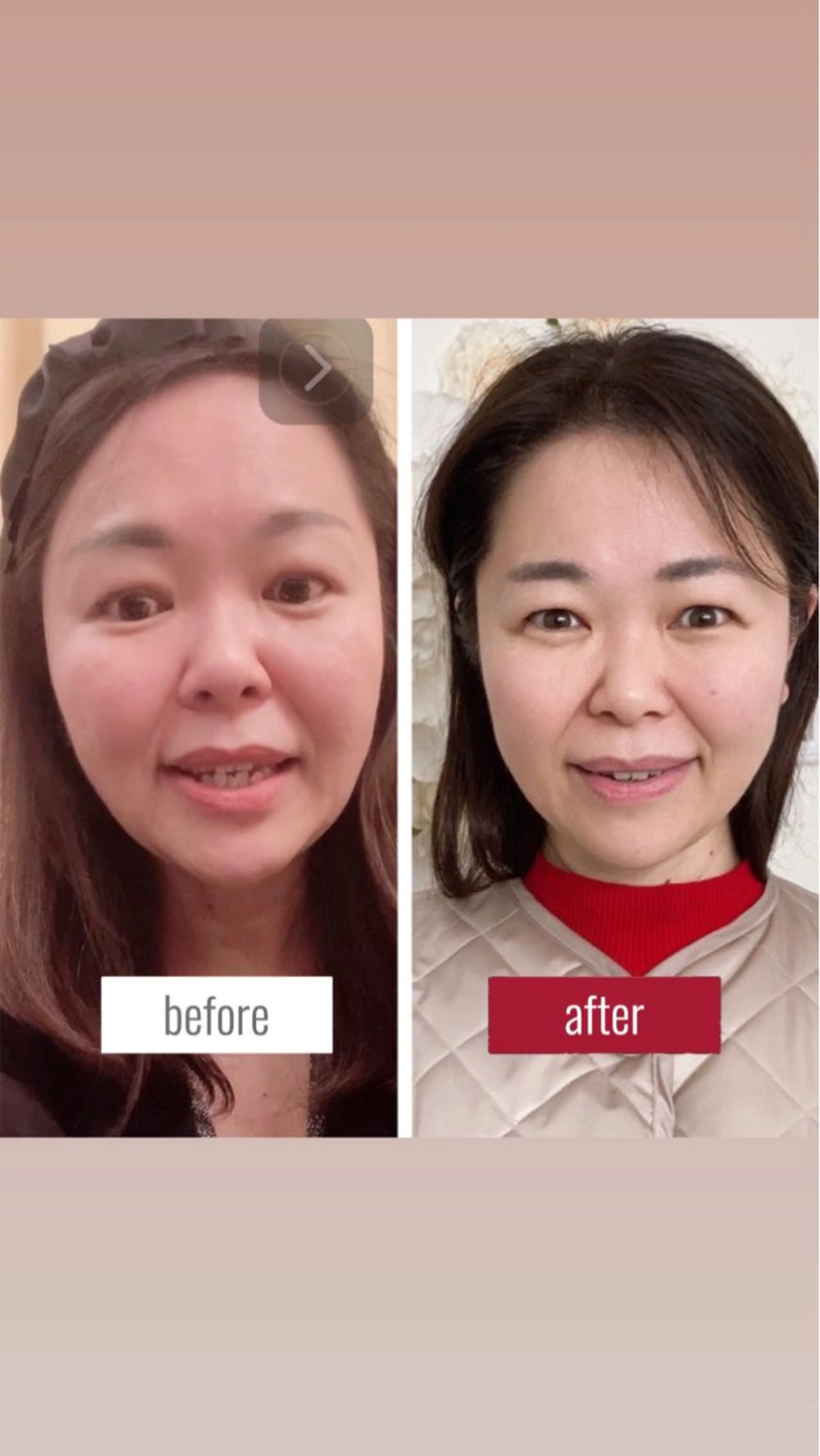 【3回券】小顔矯正+身体＋姿勢矯正フルセット60分《通常3回¥59,940》の写真