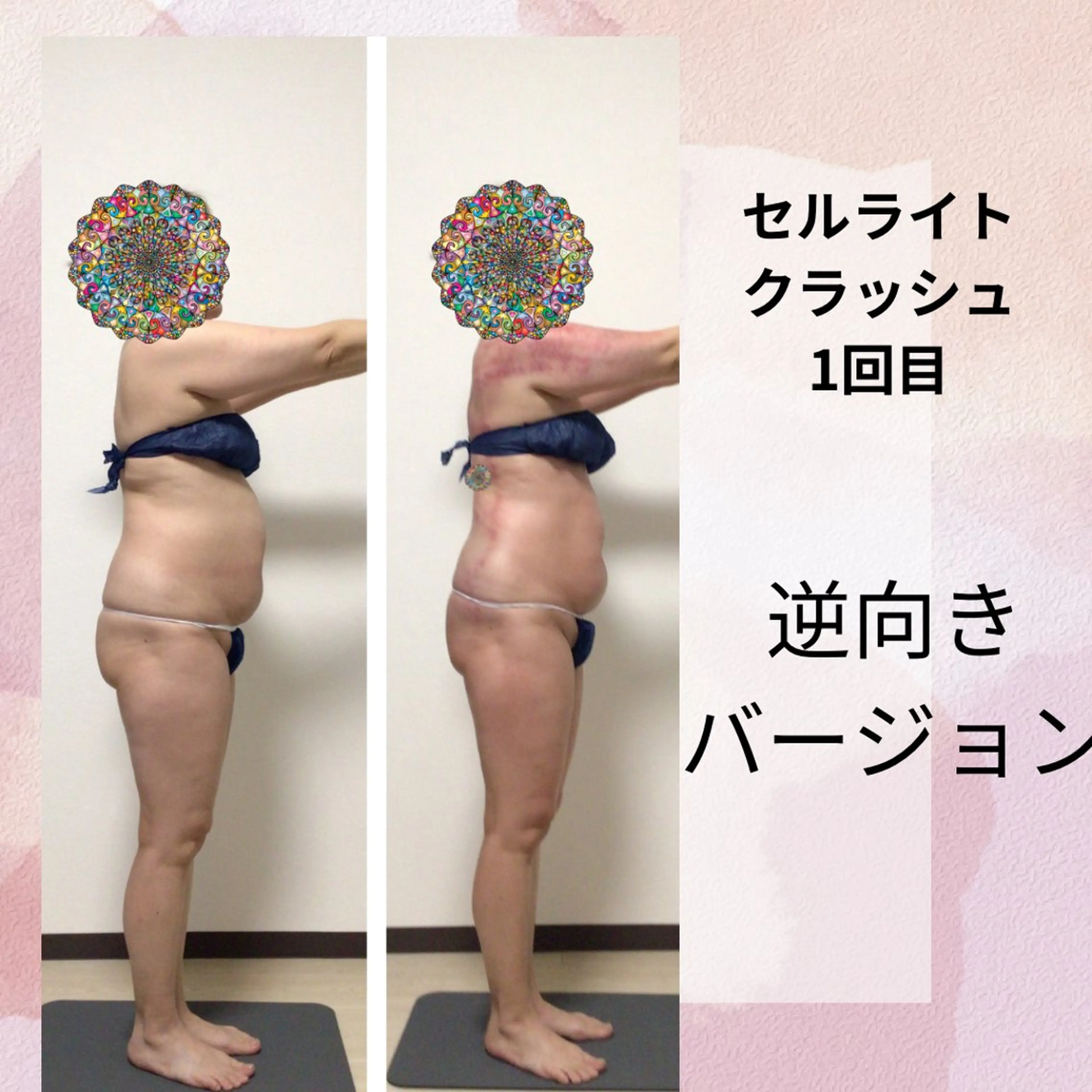 セルライトクラッシュ 腸もみ bi♡eruのエステ・リラクイメージ