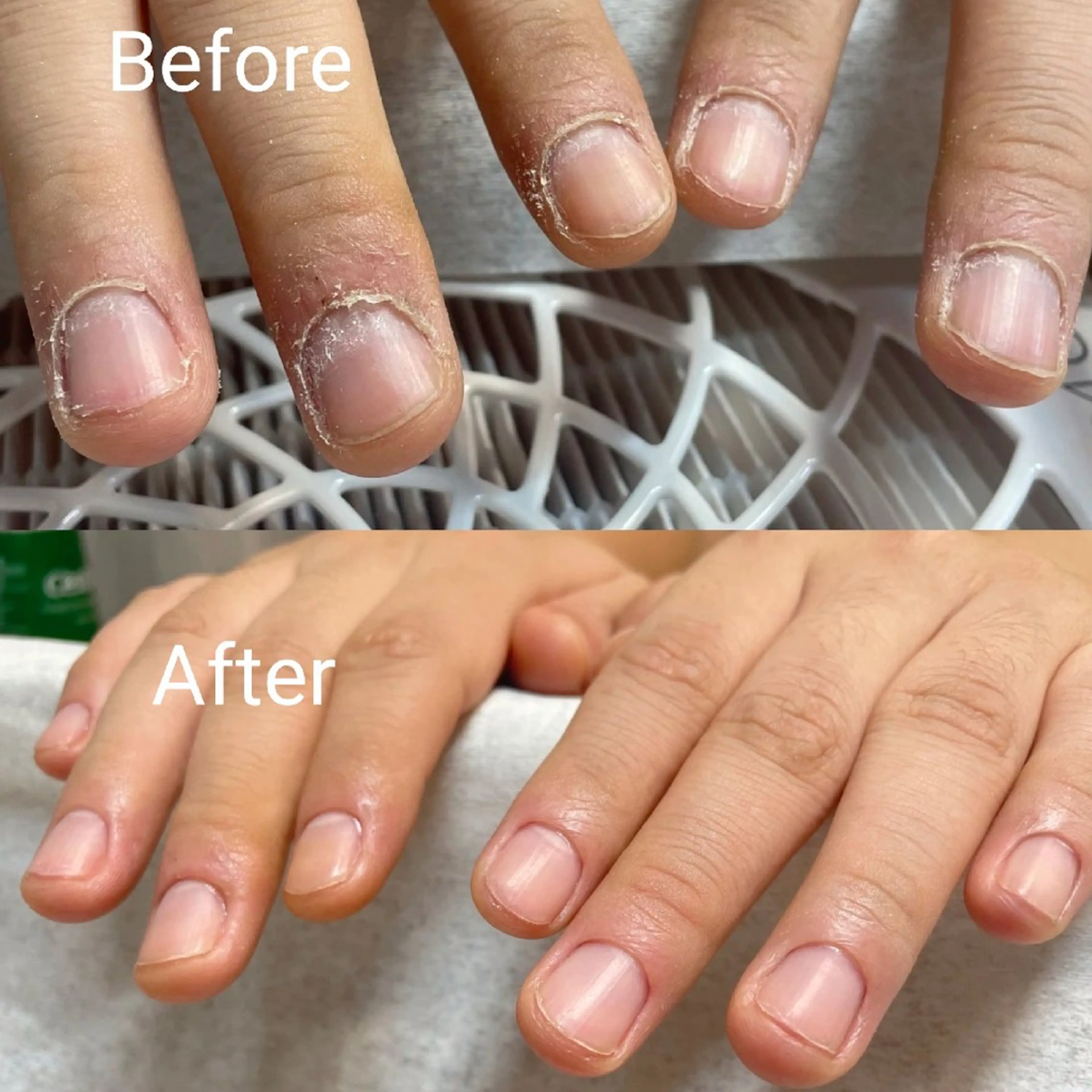 ネイル ネイリストゆか💅 長さだし、深爪矯正のネイルデザイン