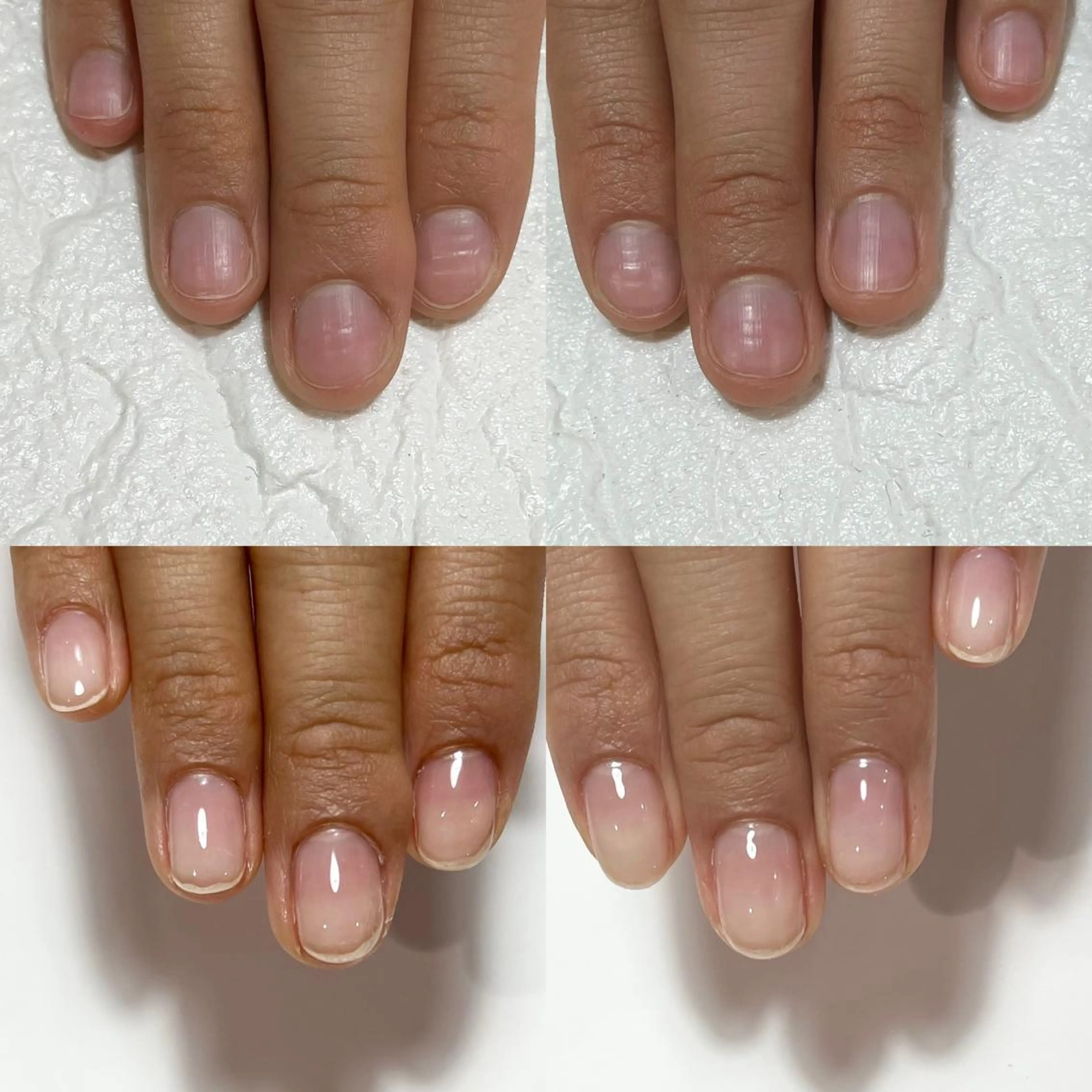 ネイル ピンク 自爪育成・巻き爪 補正講師　津蔵のネイルデザイン