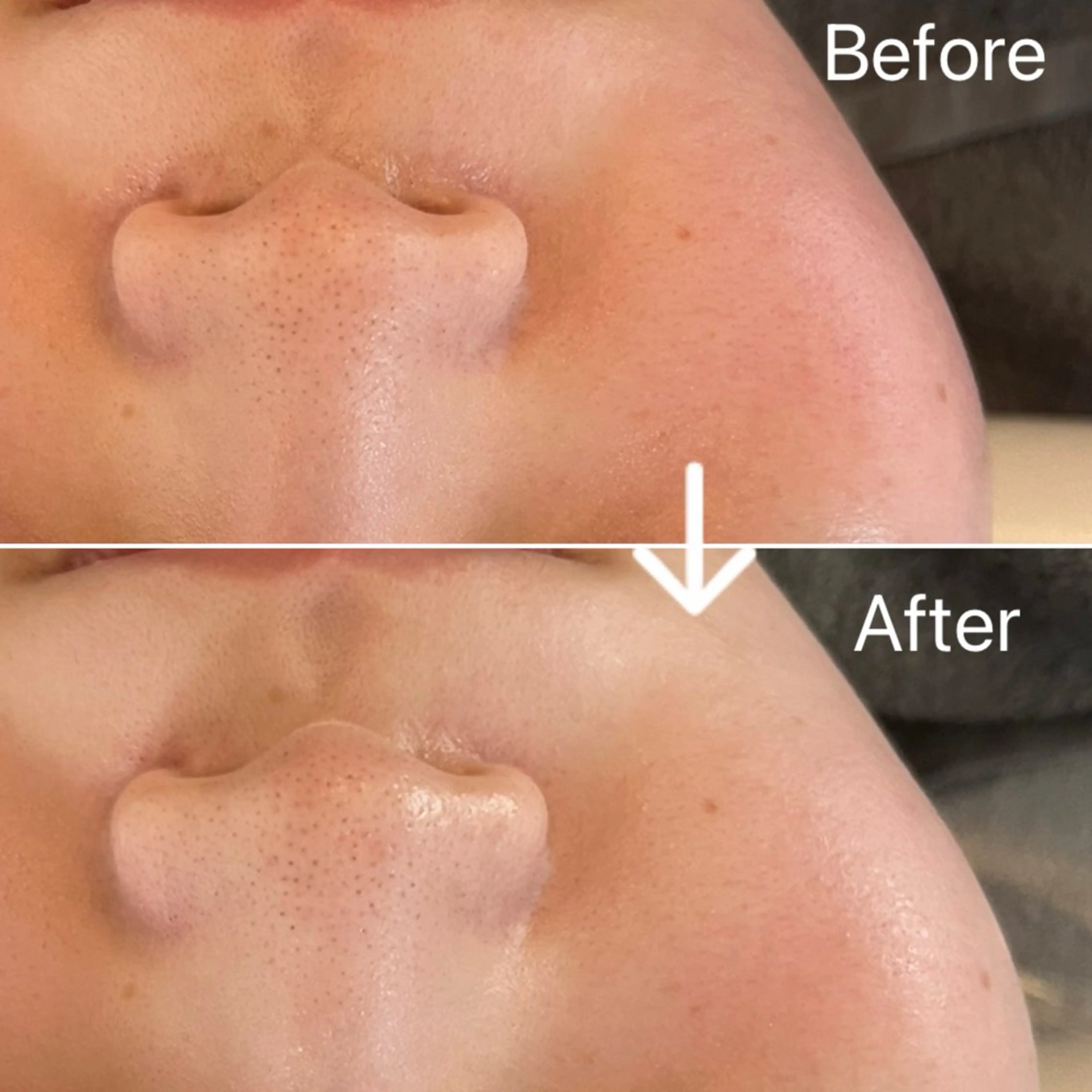 Blue Moon 【ブルームーン】のエステ・リラクイメージ