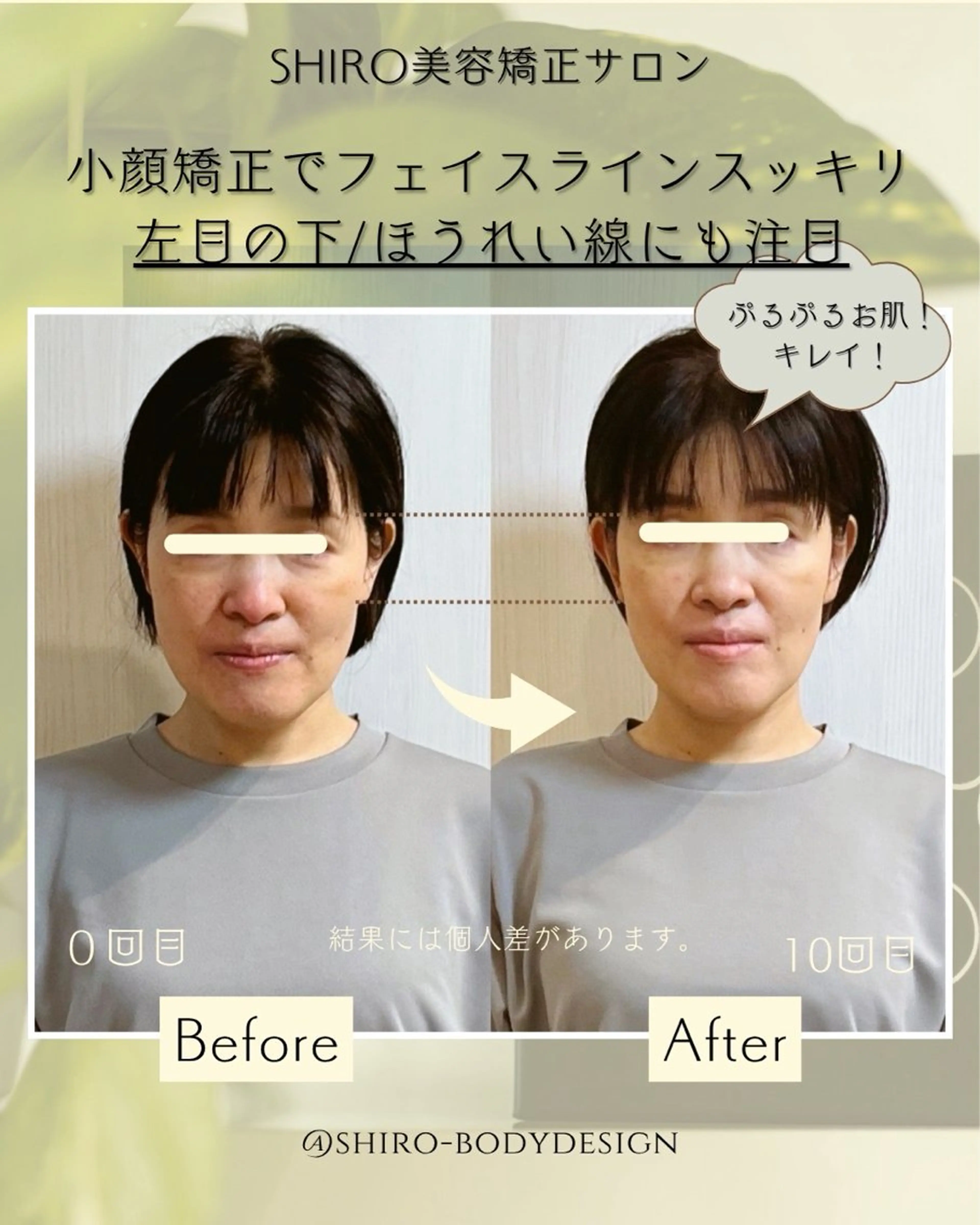 小顔美容矯正勝山式 shiroしろのエステ・リラクイメージ