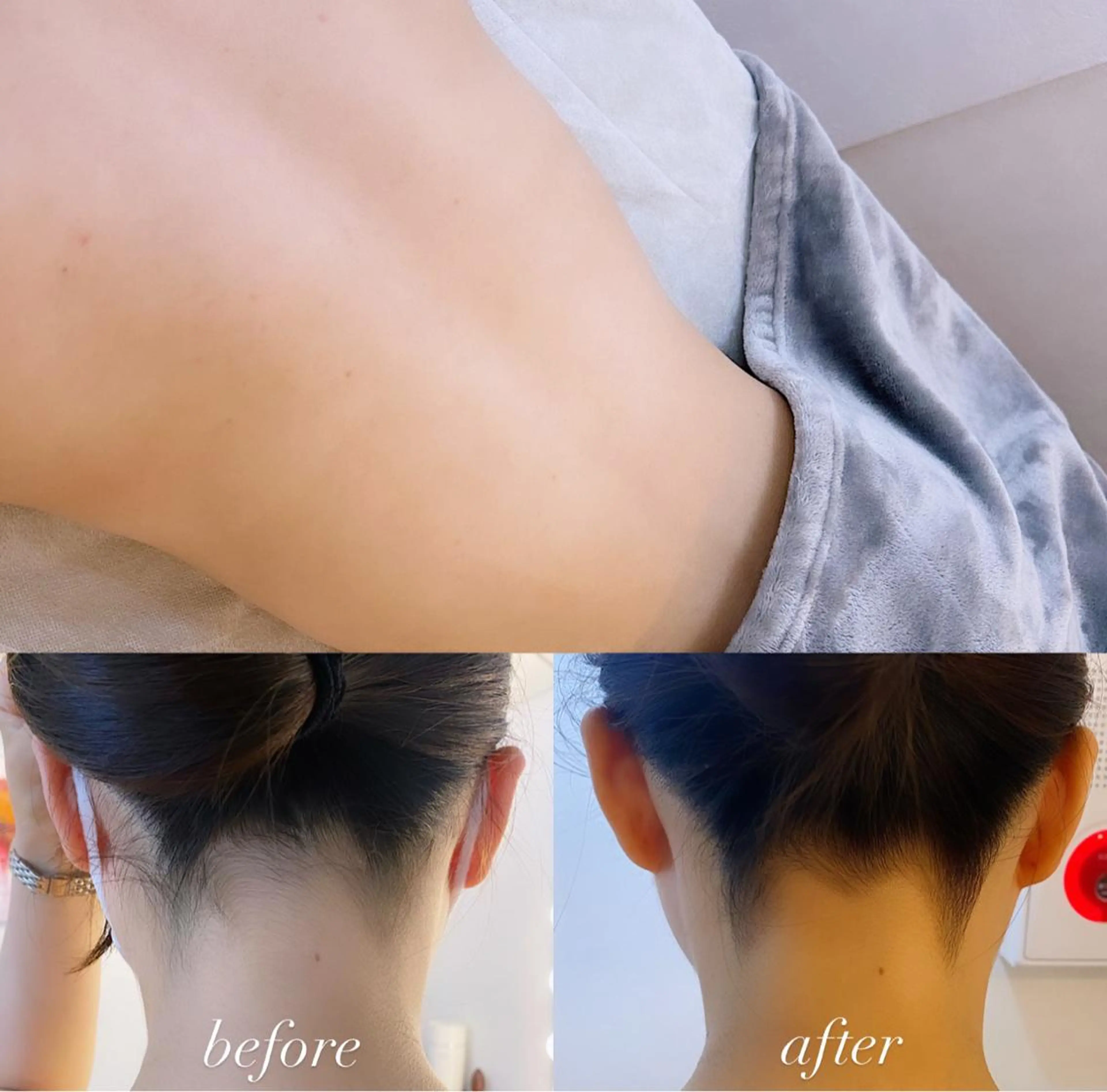 脱毛 うなじ脱毛/美肌脱毛 LABELのエステ・リラクイメージ