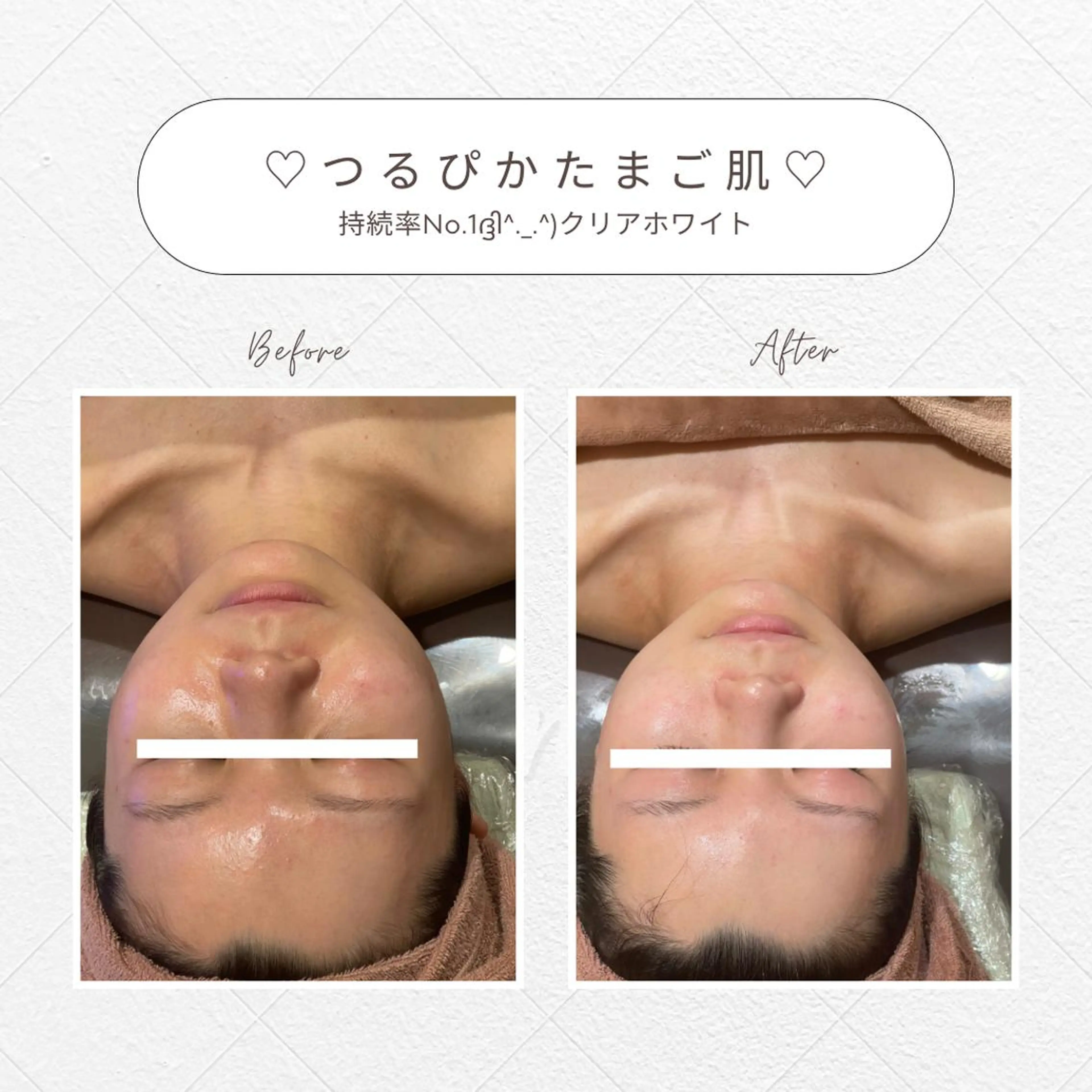 🌿小顔・痩身・脱毛 レイビス川崎店🌿のエステ・リラクイメージ