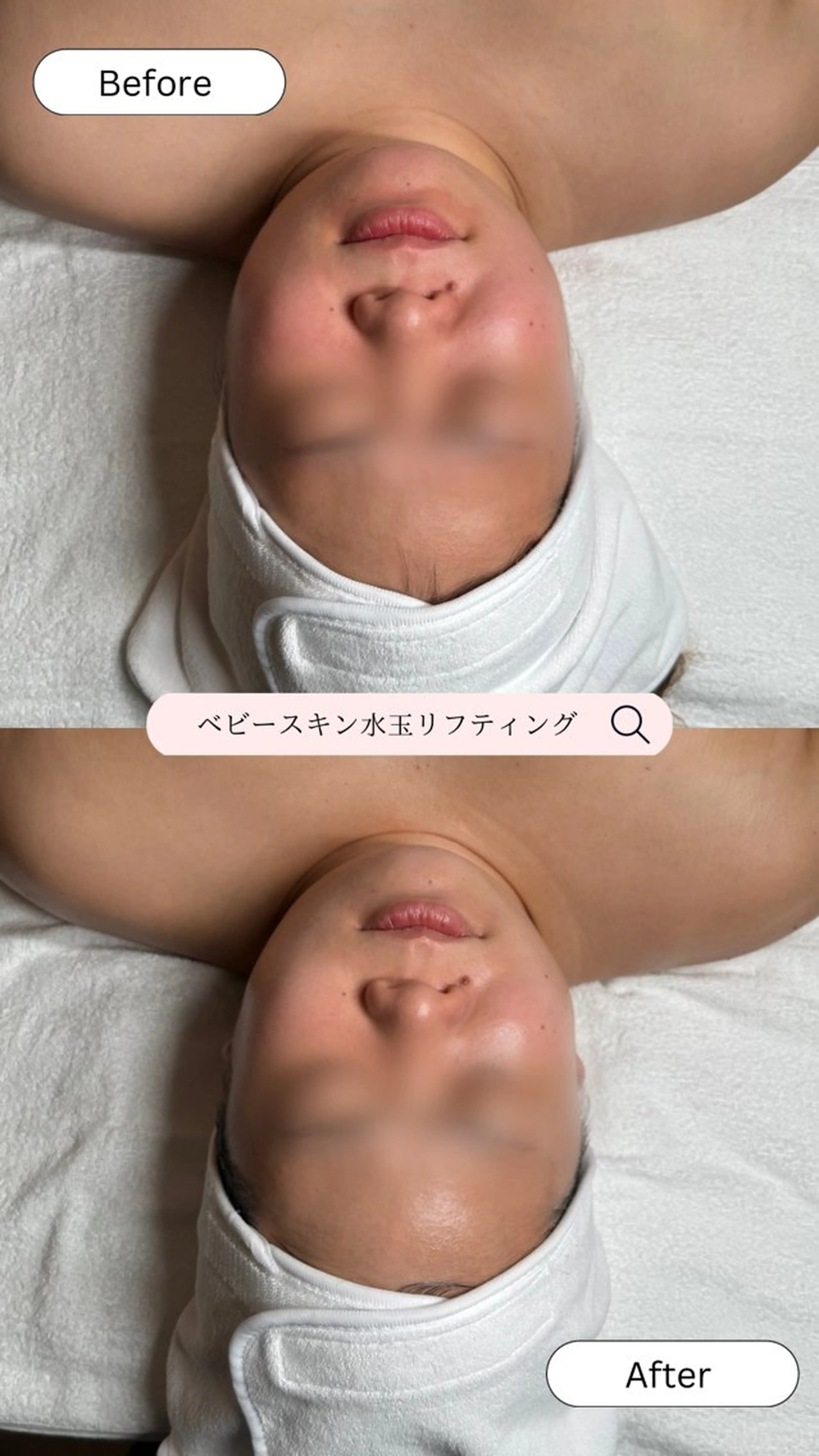 韓国肌管理🫧LDM 🫧Junnaのエステ・リラクイメージ