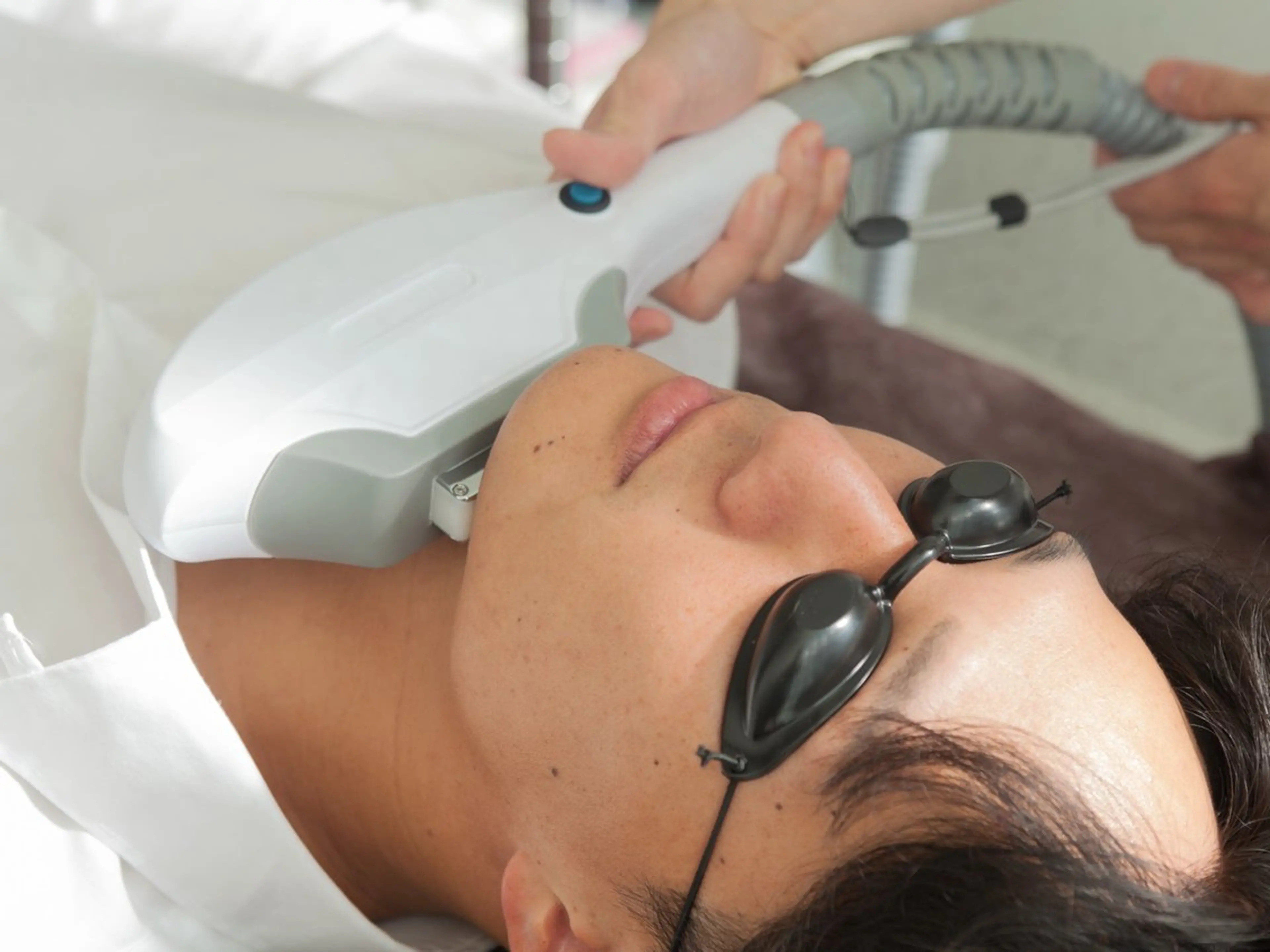 【Open記念】※12月限定 効果◎【ヒゲ脱毛】ヒゲ全体 　56％OFF ¥7900→¥3450の写真