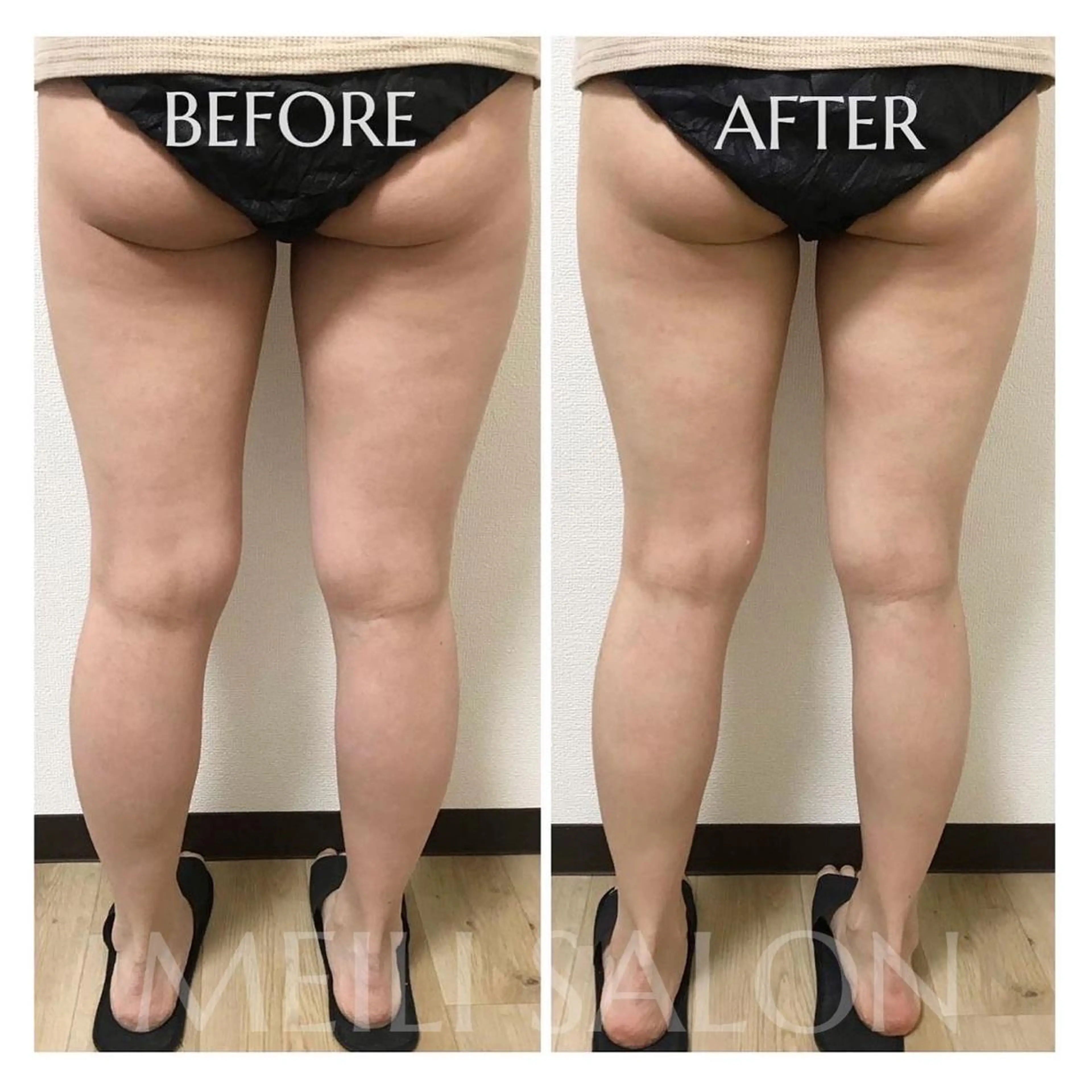 Private  Beauty Salon " MEILI"所属・meili salonのエステ・リラクイメージ