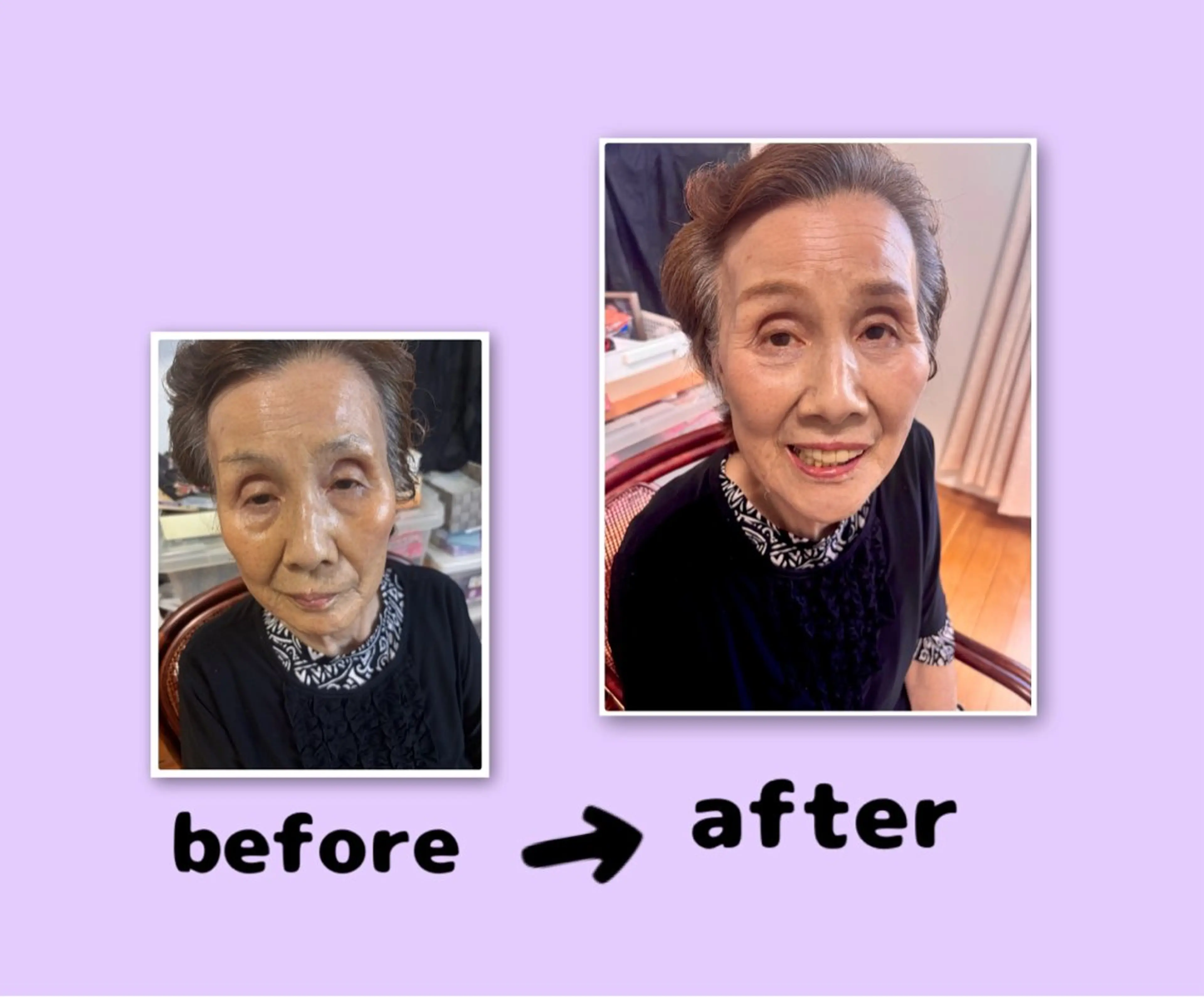 YUI🤍肌悩みに ＊速攻透明感！のエステ・リラクイメージ