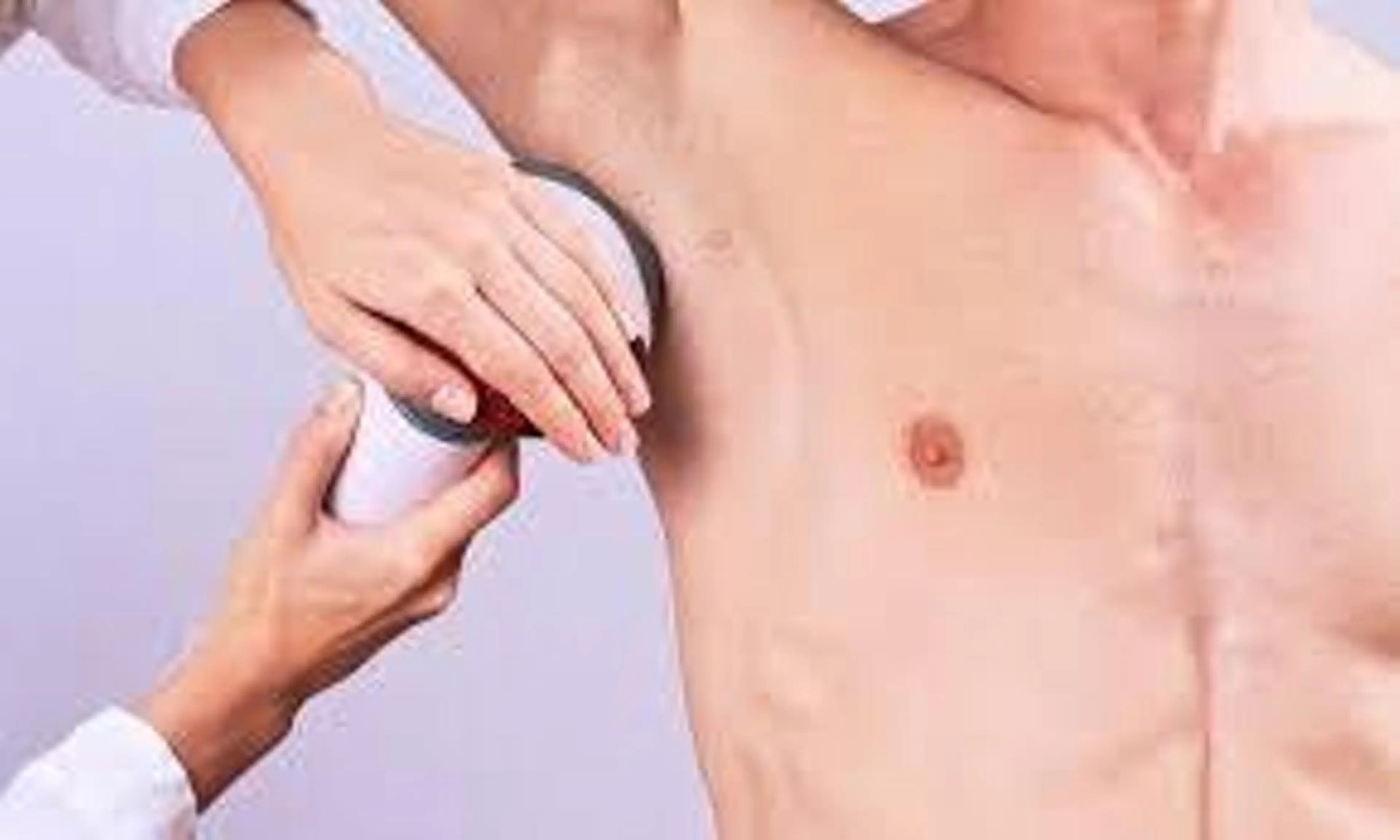 【初回★minimo男性限定】メンズ痛くない♪高速全身脱毛（顔orVIO）の写真